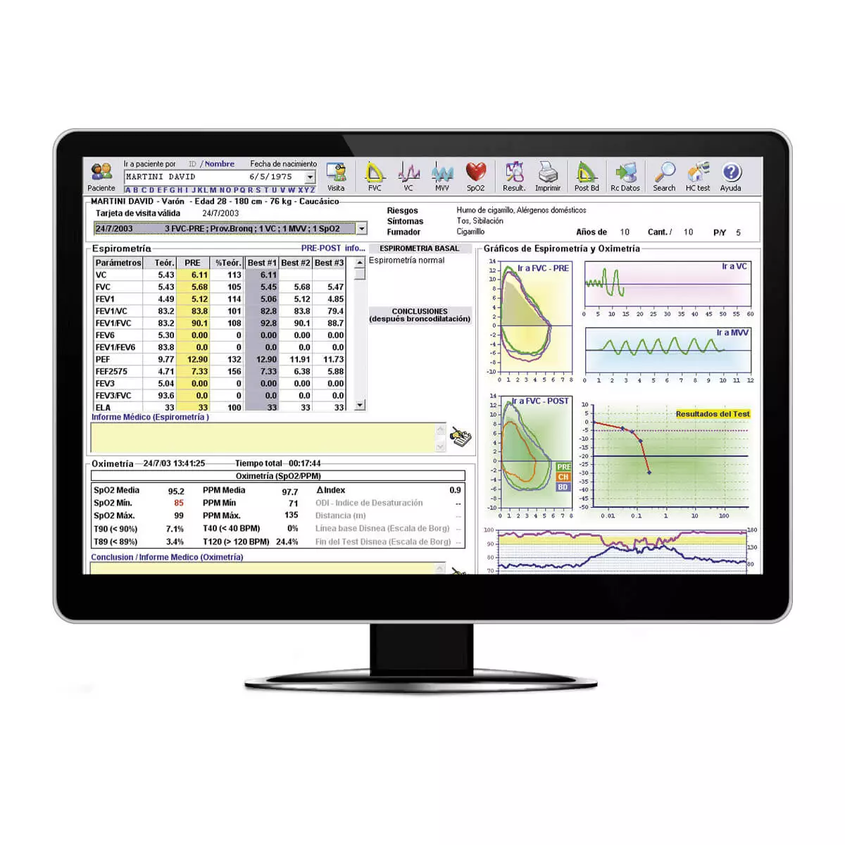 MIR Minispir PC-Spirometer