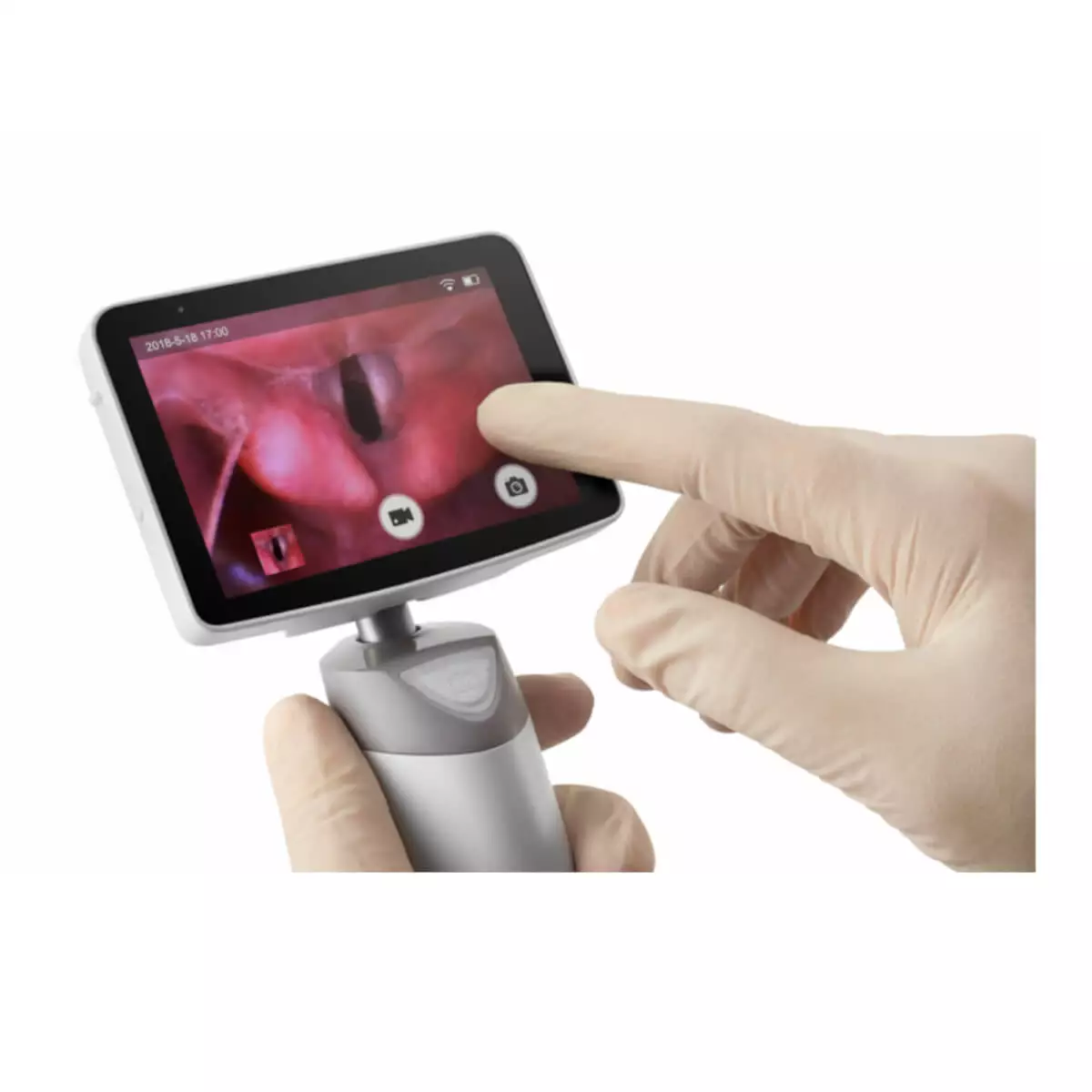 MedCaptain VS-10 Video-Laryngoskop