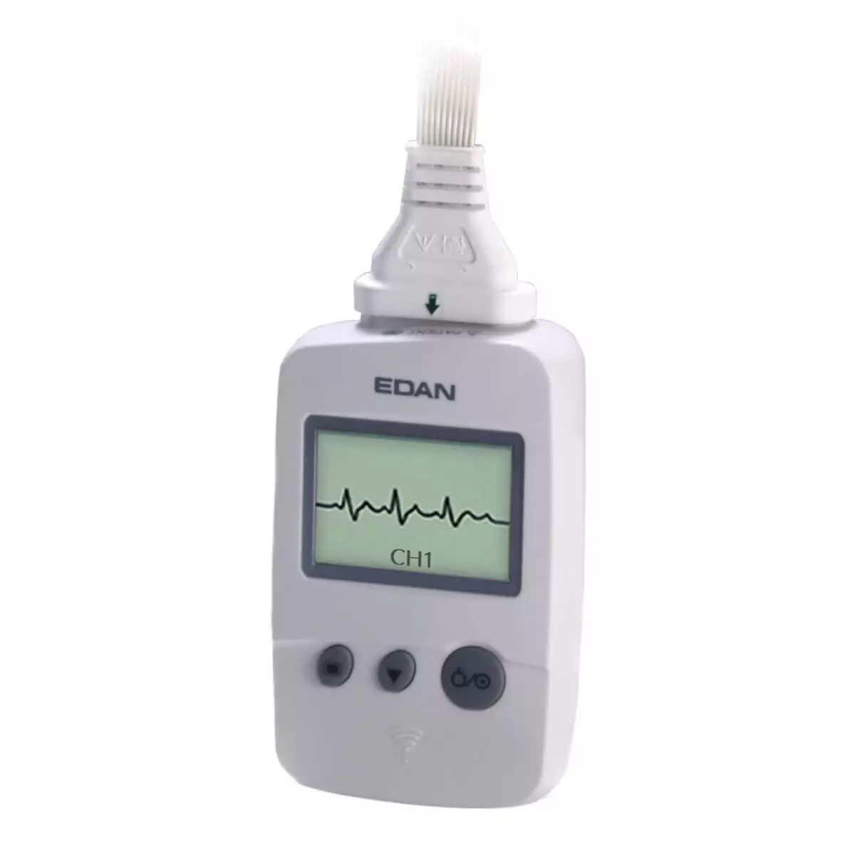 EDAN SE-1515 EKG Datenmanagement-Software EDAN SE-1515 EKG Datenmanagement-Software