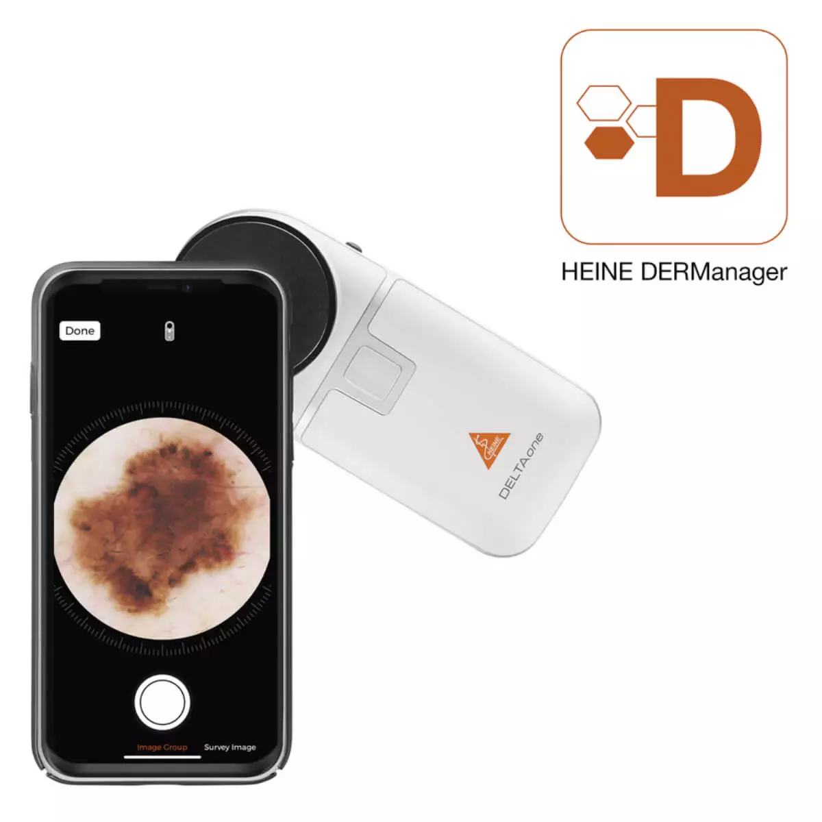HEINE Optotechnik HEINE DELTAone Dermatoskop