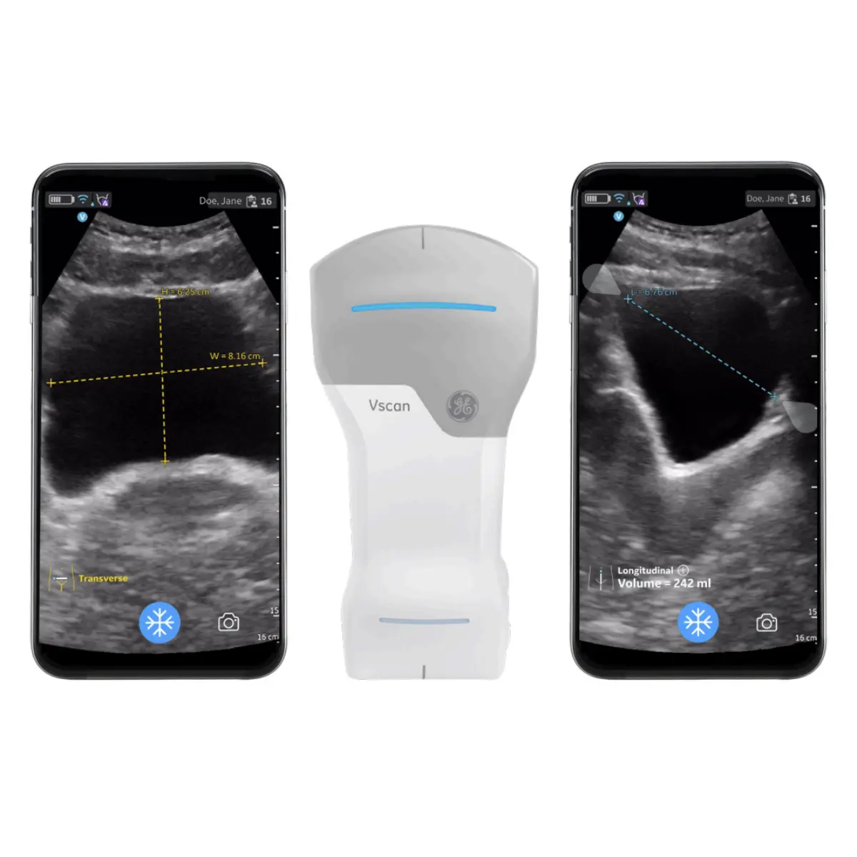 GE Healthcare Auto-Bladder-Volume-Upgrade für VScan Air CL GE Healthcare Auto-Bladder-Volume-Upgrade für VScan Air CL
