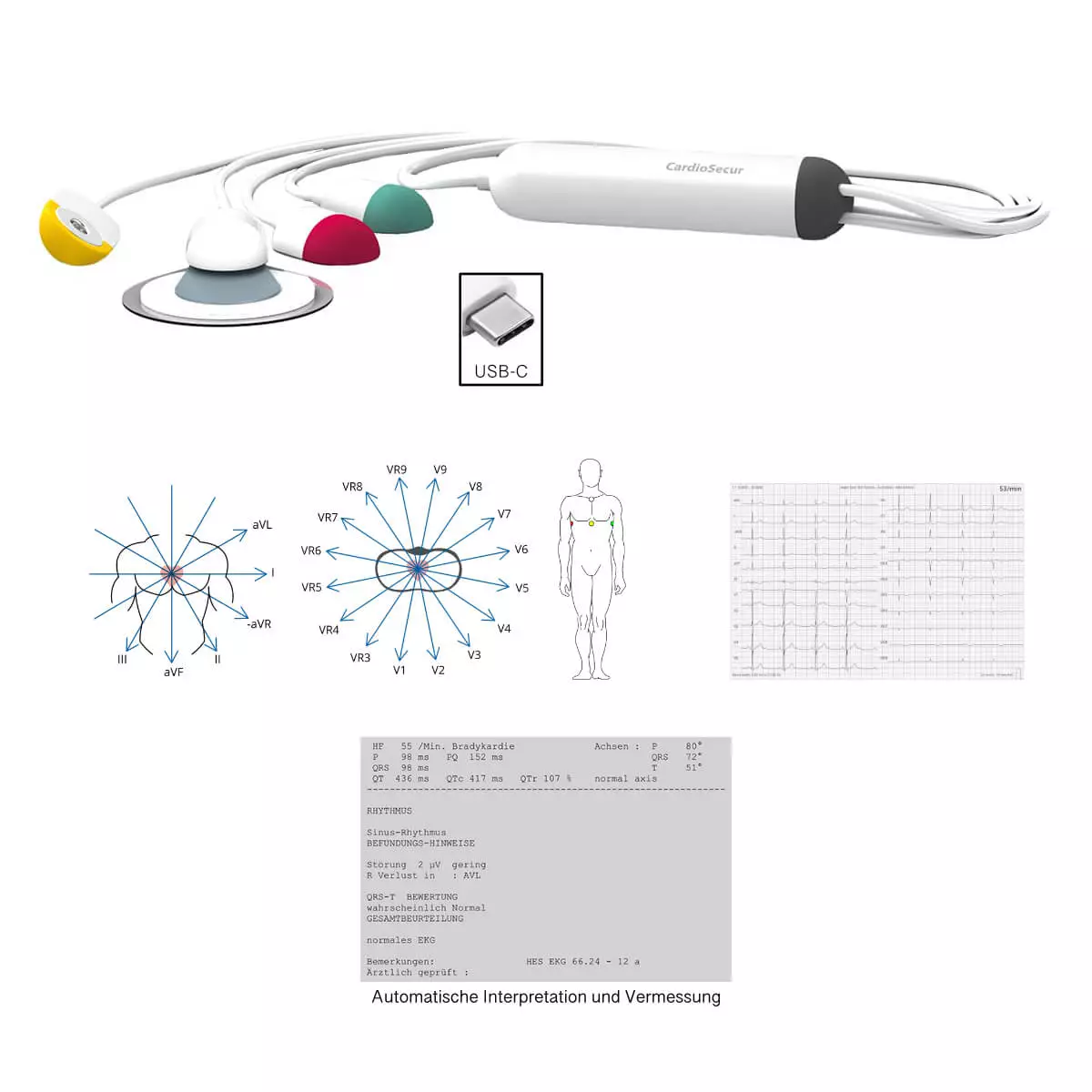 CardioSecur CardioSecur Pro EKG
