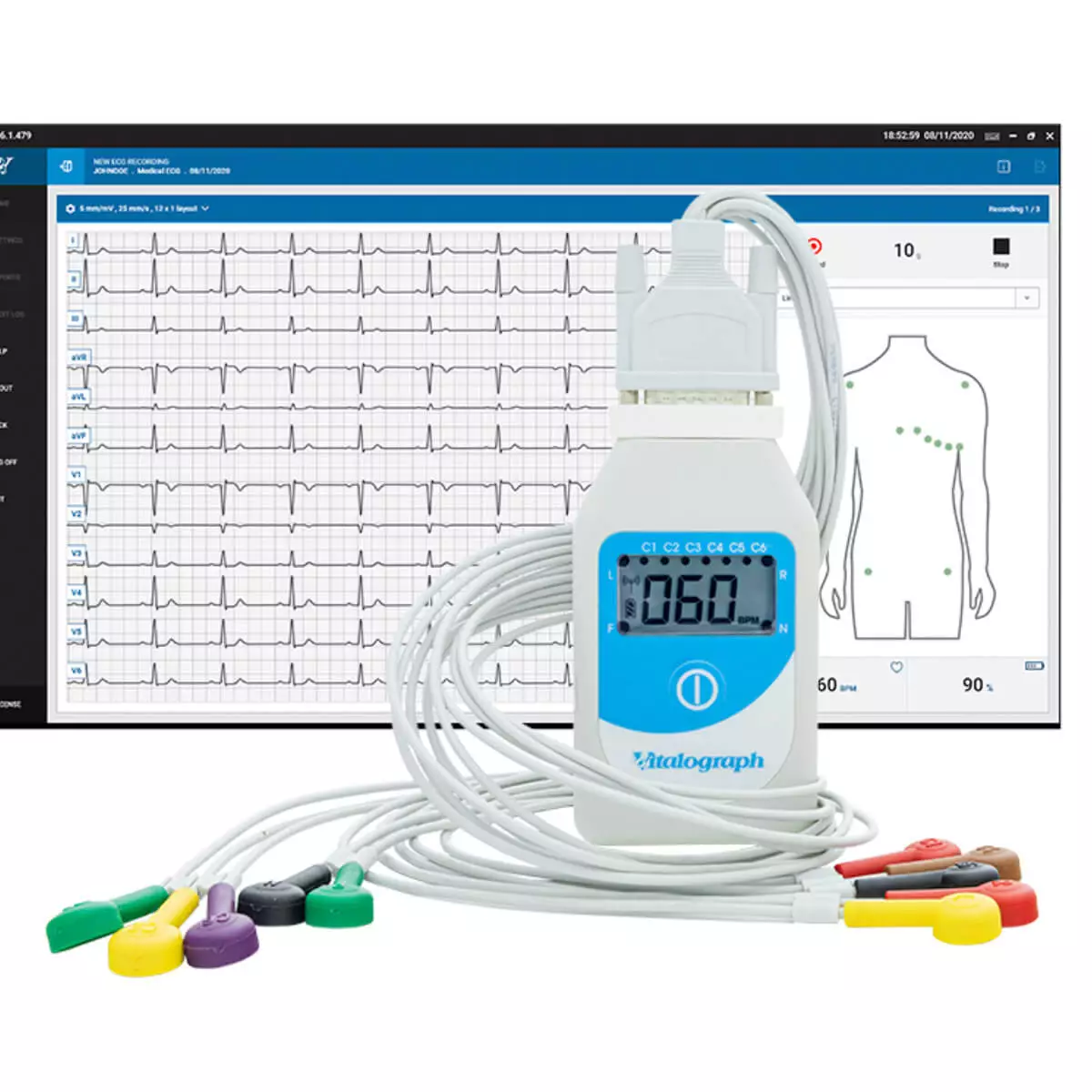 Vitalograph BT12 Ruhe-EKG mit Bluetooth-Konnektivität