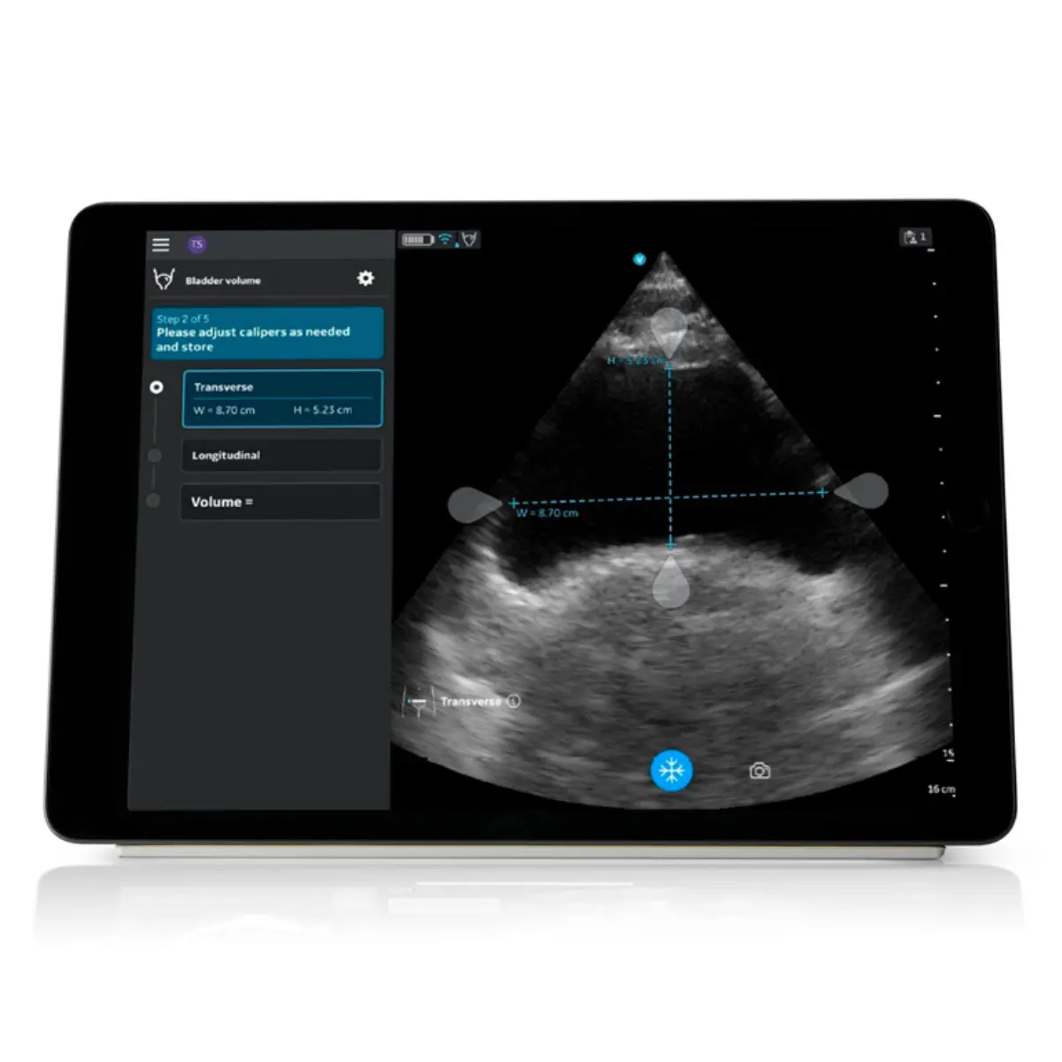GE Healthcare Auto-Bladder-Volume-Upgrade für VScan Air CL GE Healthcare Auto-Bladder-Volume-Upgrade für VScan Air CL