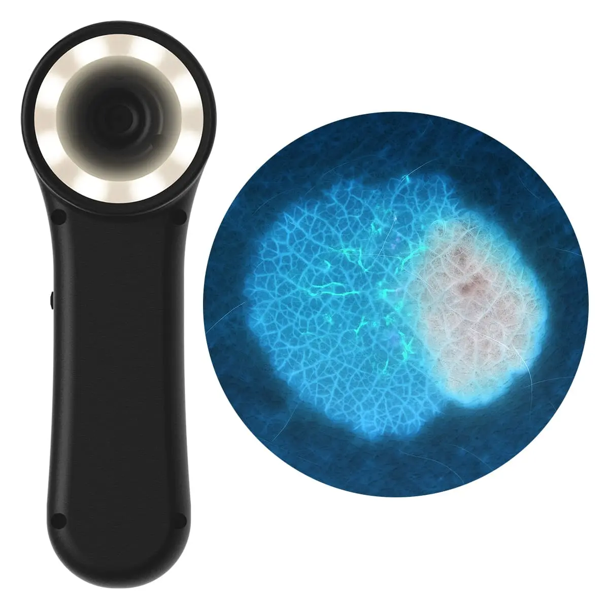 DocCheck Thïngs Digitales Dermatoskop "Scaut®"