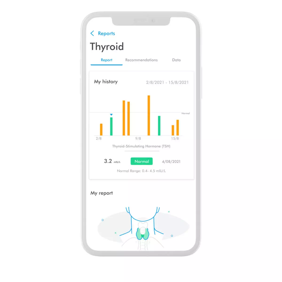 Bloom Diagnostics Bloom Thyroid Test Bloom Diagnostics Bloom Thyroid Test