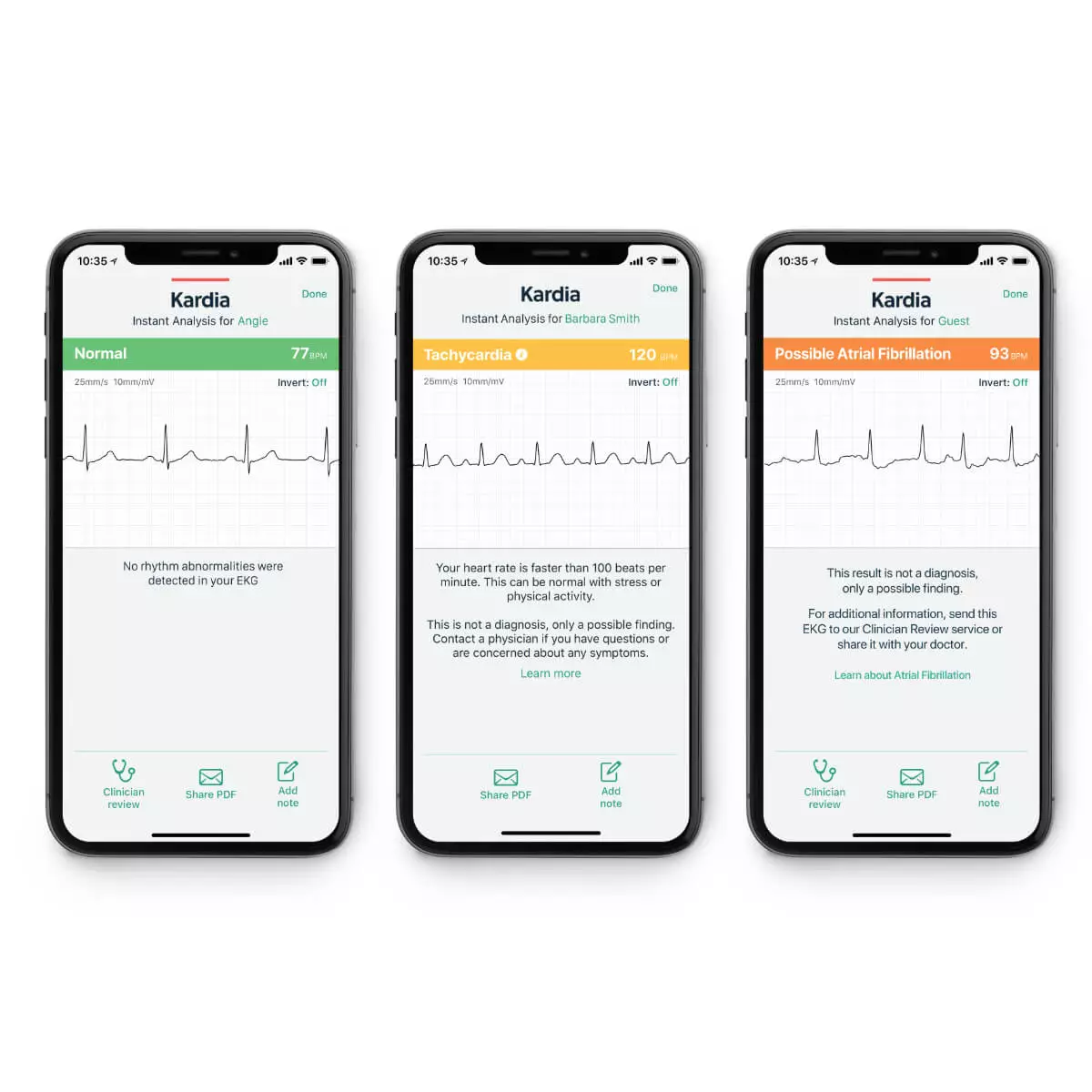AliveCor KardiaMobile® Smartphone 1-Kanal-EKG