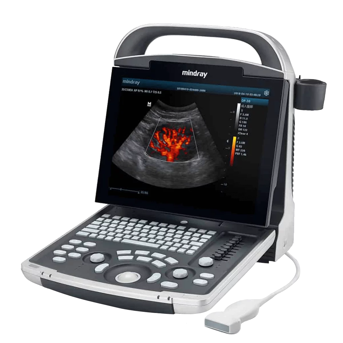 Mindray DP-30 Ultraschallgerät Mindray DP-30 Ultraschallgerät