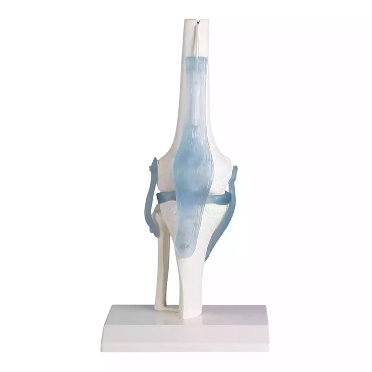 Erler-Zimmer Kniegelenk Modell