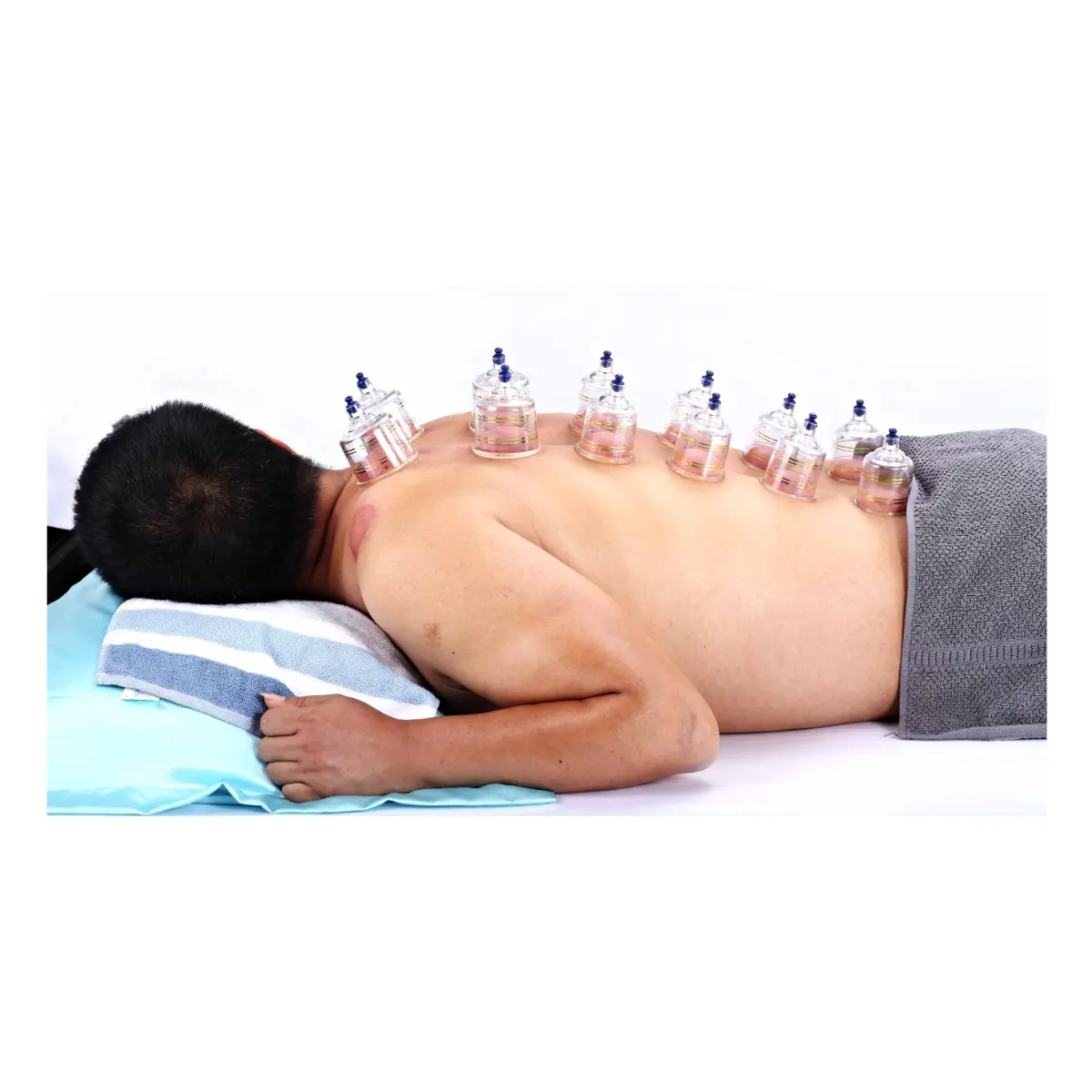AcuTop Schröpfkopf-Set mit Vakuum-Handpumpe AcuTop Schröpfkopf-Set mit Vakuum-Handpumpe