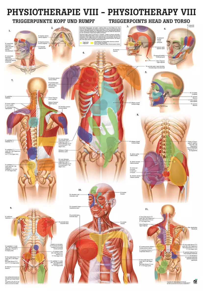 Rüdiger Anatomie Lehrtafel – Triggerpunkte Kopf und Rumpf