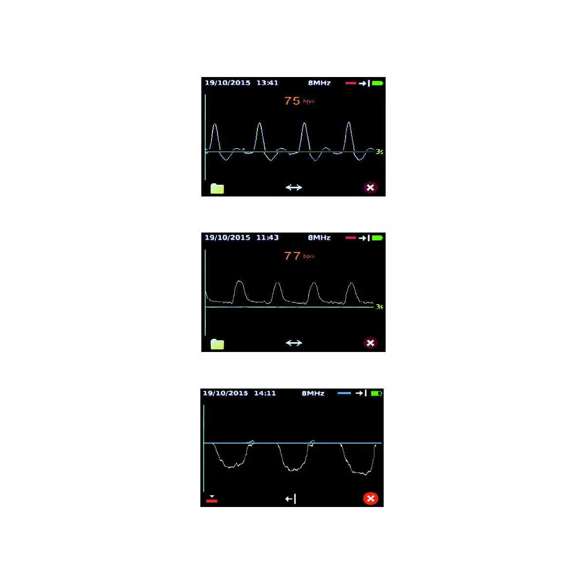 Huntleigh Dopplex DMX Gefäßdoppler