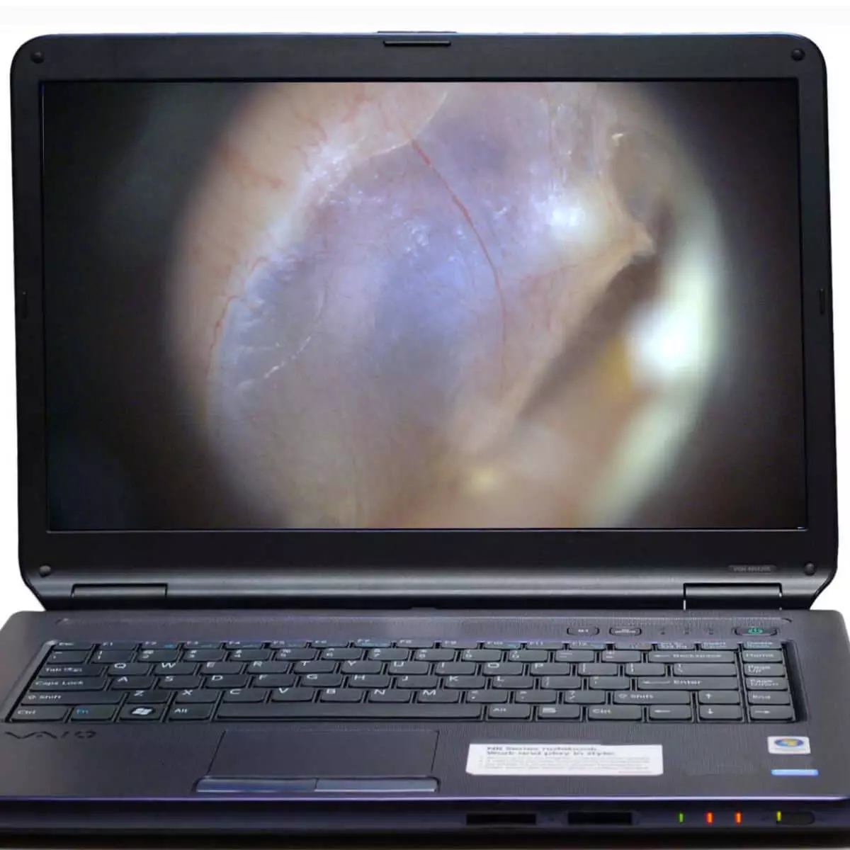 Dino-Lite EarScope Pro Wireless Videootoskop