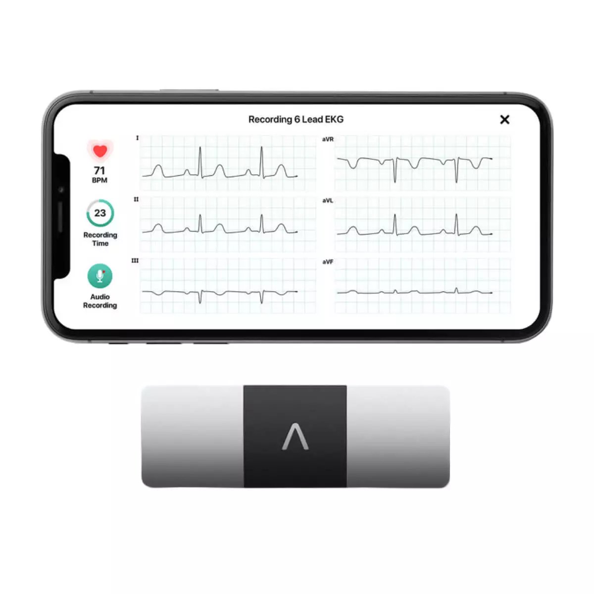 AliveCor KardiaMobile® 6L Smartphone 6-Kanal-EKG