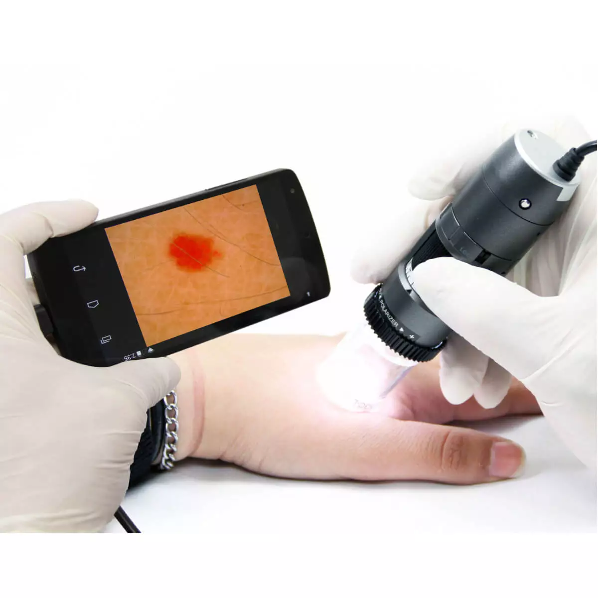 Dino-Lite DermaScope Polarizer HR 200x Videodermatoskop
