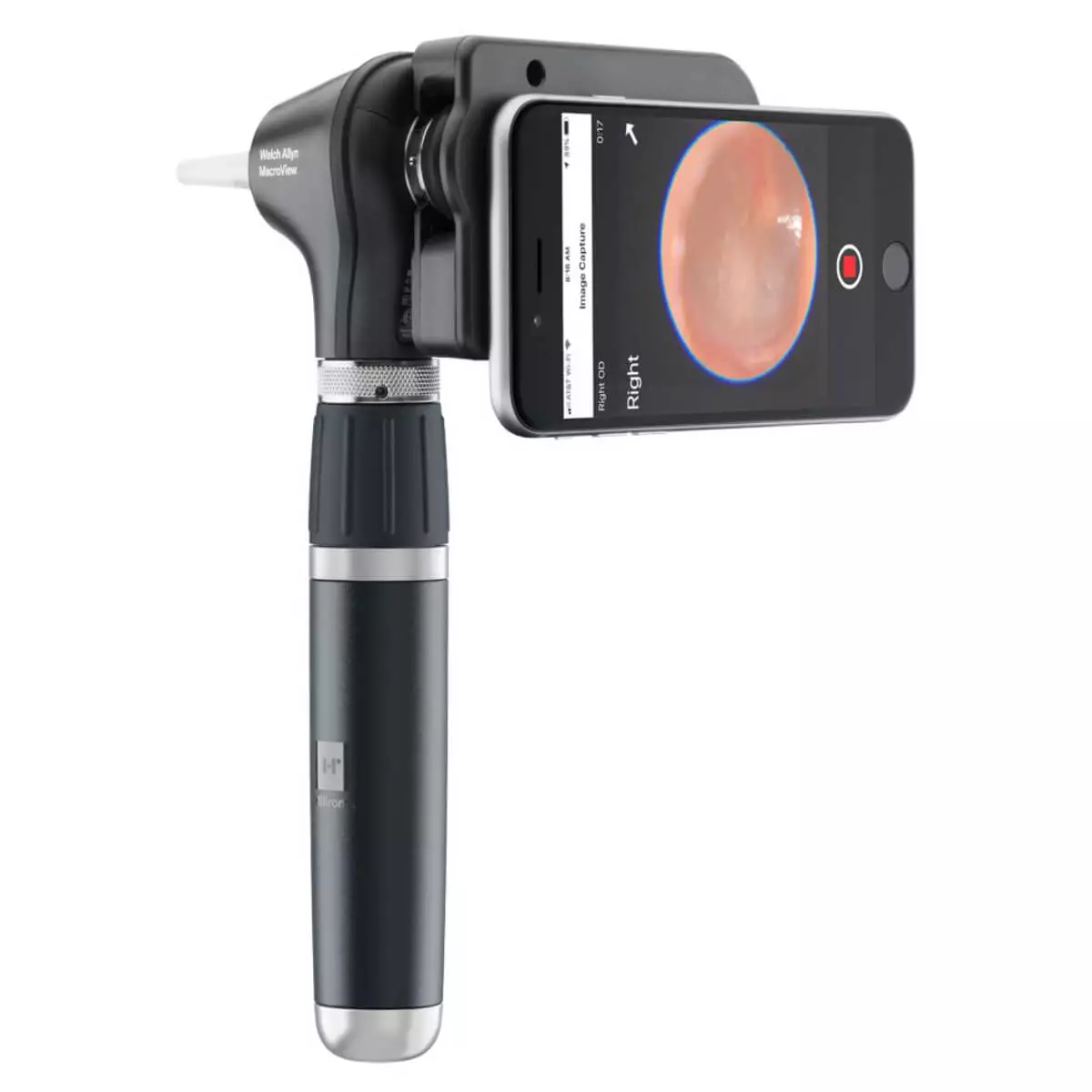 Welch Allyn Diagnostik-Set mit MacroView Plus Otoskop & iExaminer-Kit