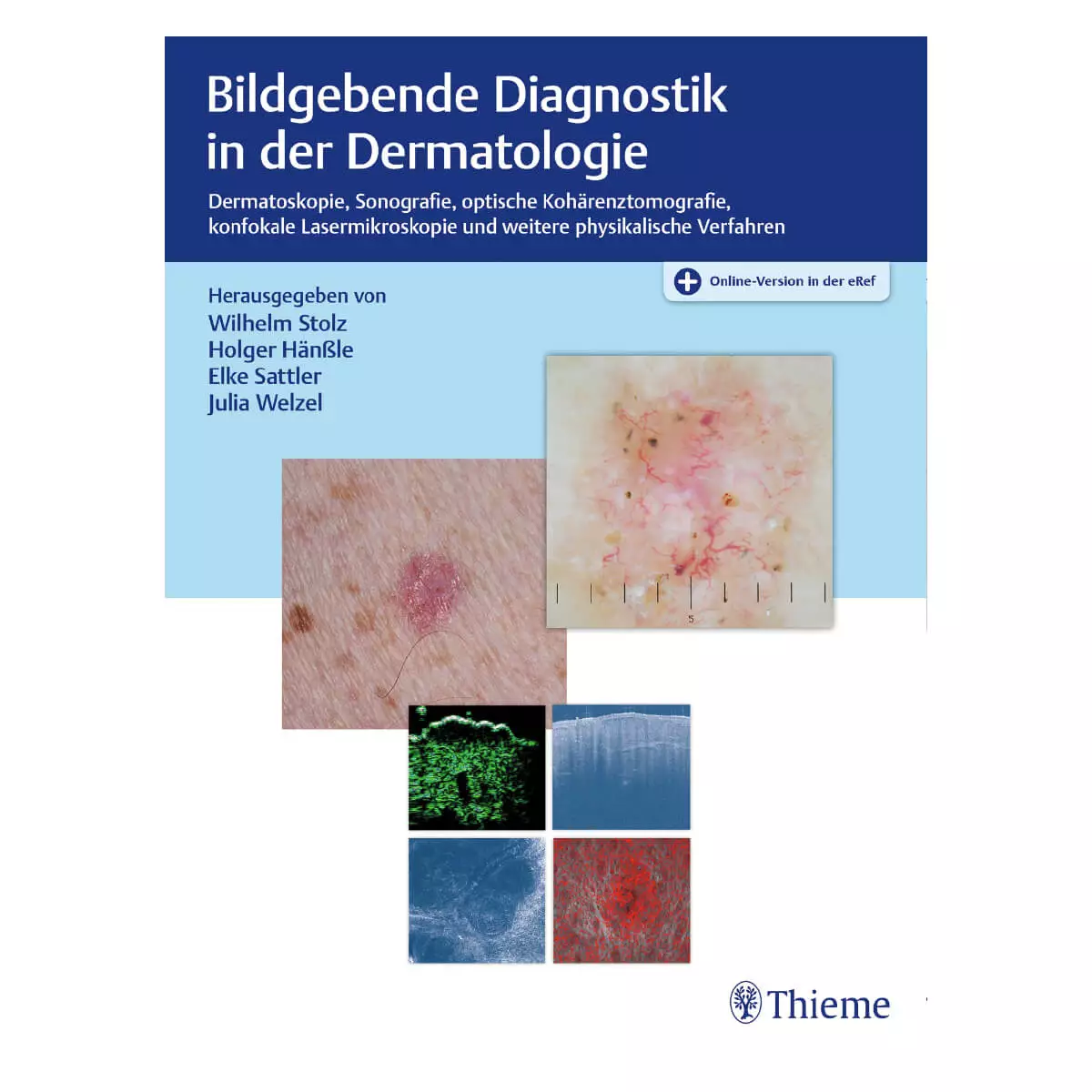 Thieme Bildgebende Diagnostik in der Dermatologie