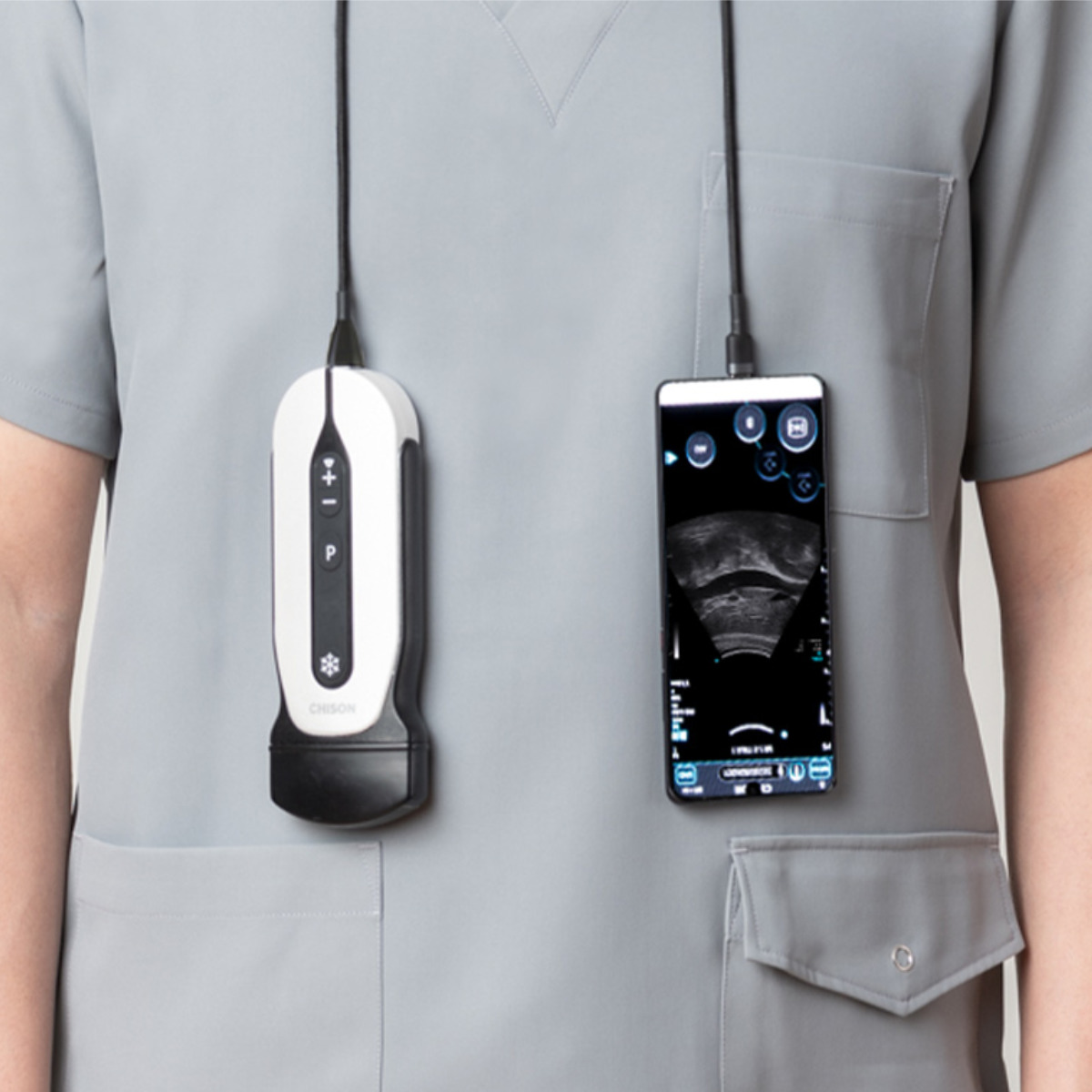 CHISON SonoEye mobiles Ultraschallsystem CHISON SonoEye mobiles Ultraschallsystem