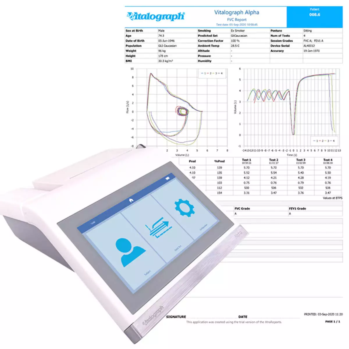 Vitalograph ALPHA Connect All-in-One Spirometer