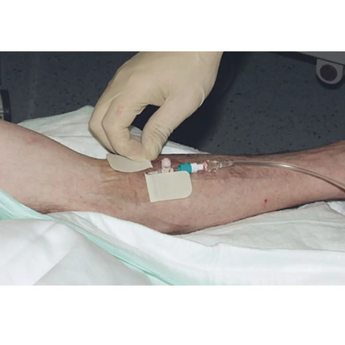 NOBAMED RUDAVEN-transparent Kanülenfixierpflaster