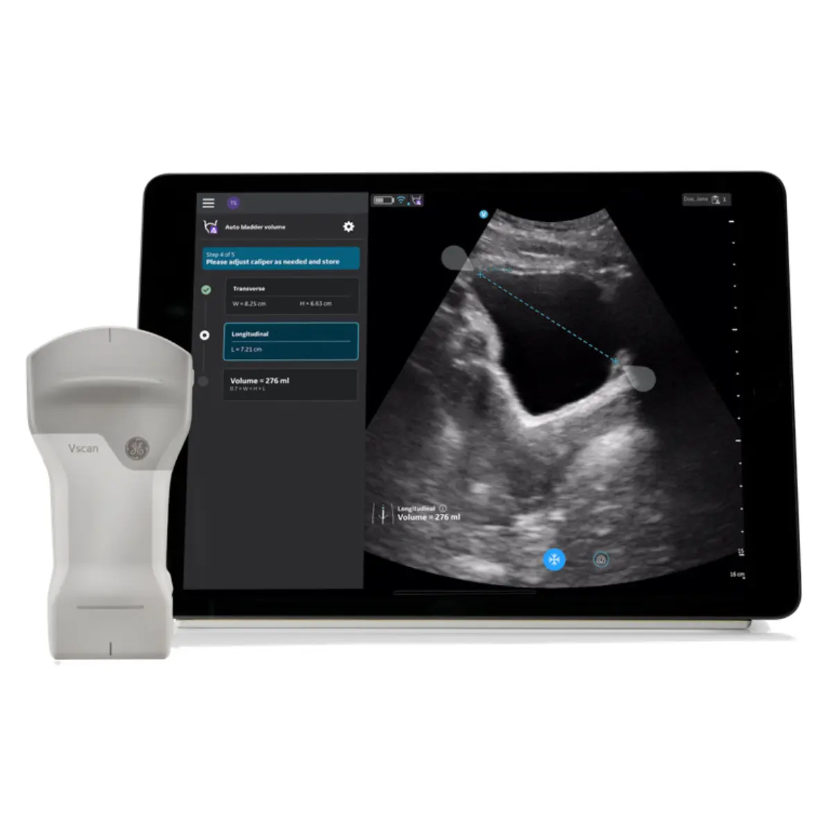 GE Healthcare Auto-Bladder-Volume-Upgrade für VScan Air CL GE Healthcare Auto-Bladder-Volume-Upgrade für VScan Air CL