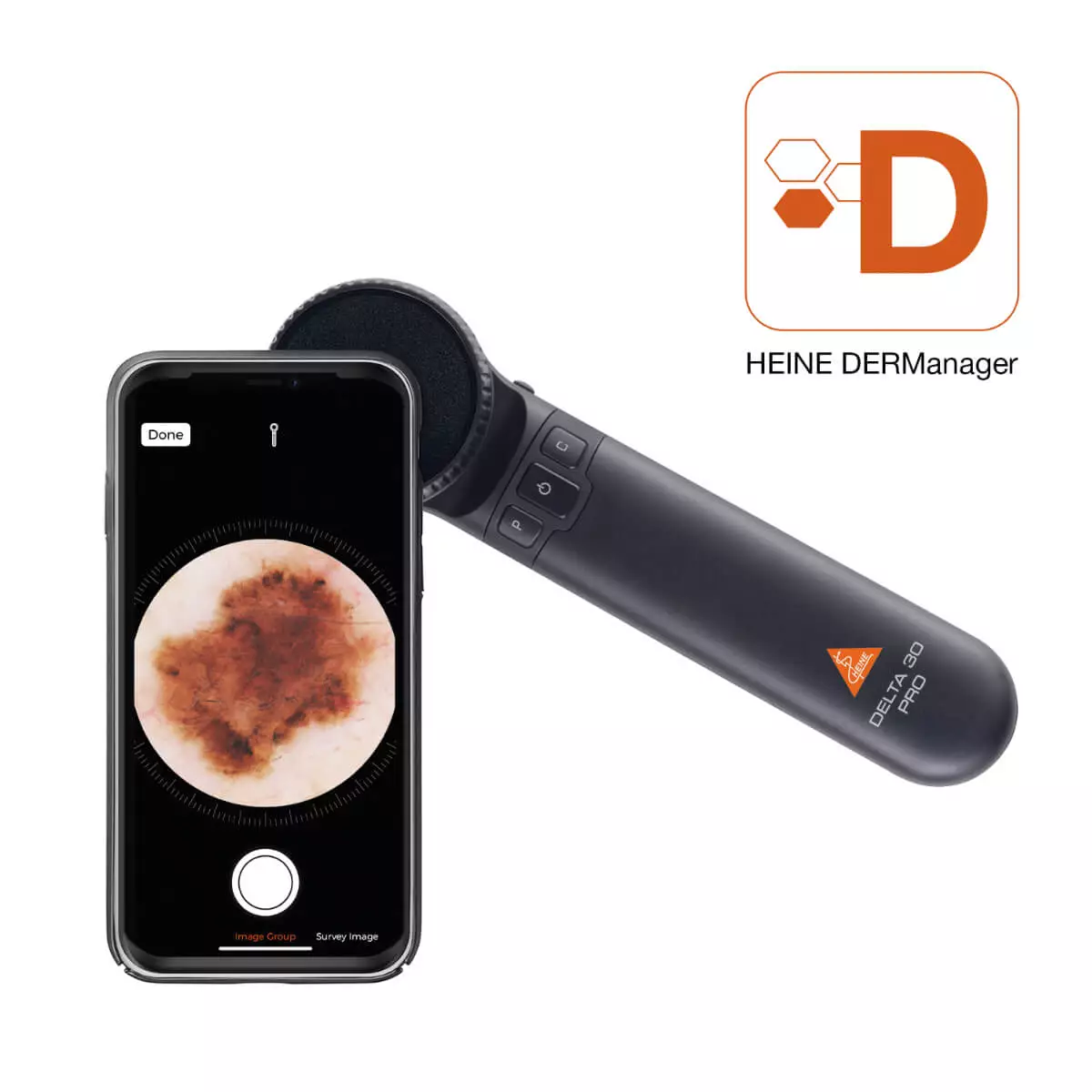 HEINE Optotechnik HEINE DELTA 30 PRO Dermatoskop