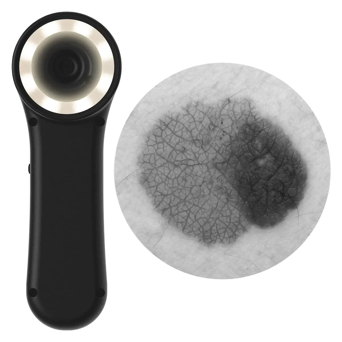 DocCheck Thïngs Digitales Dermatoskop "Scaut®"