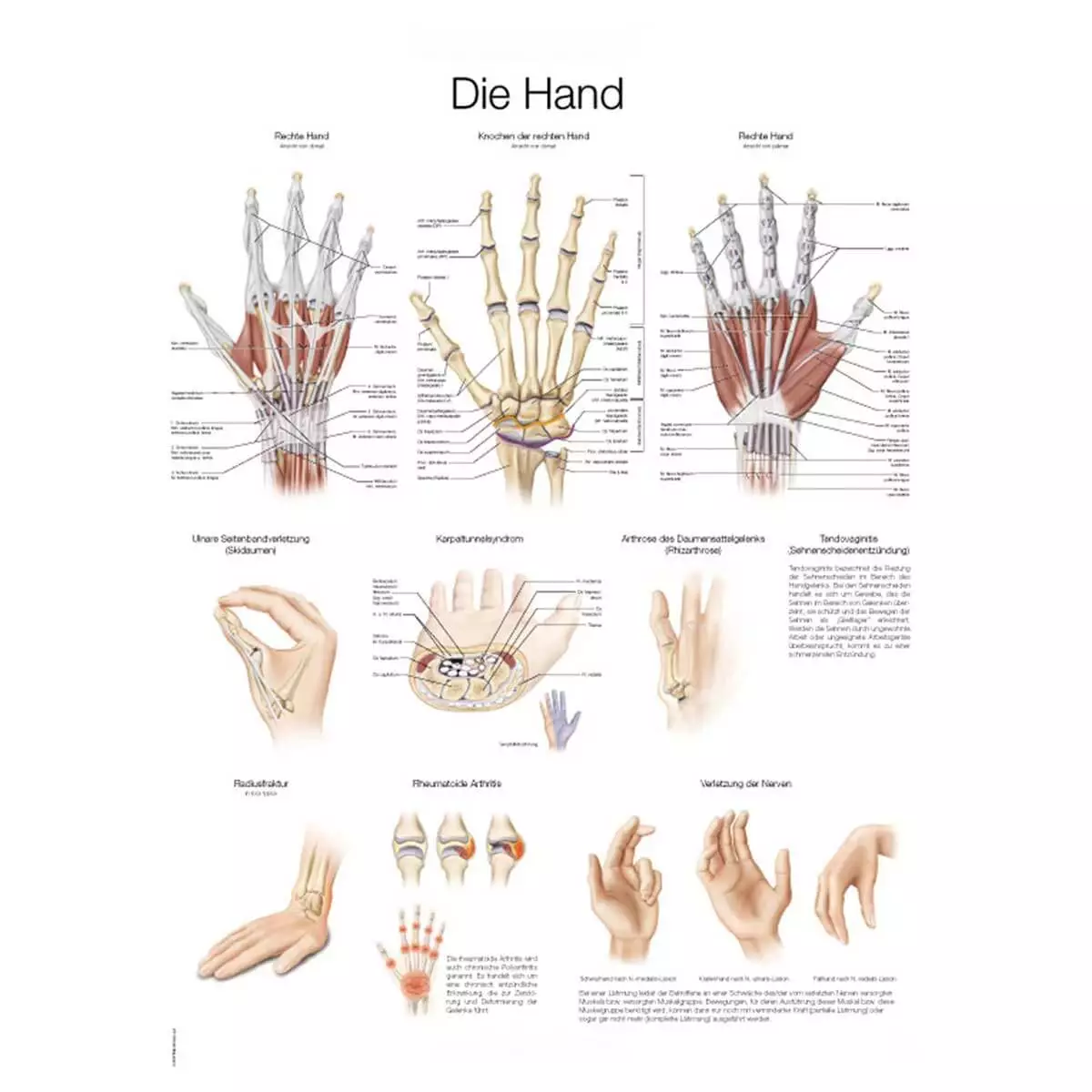 Erler-Zimmer Lehrtafel – Die Hand
