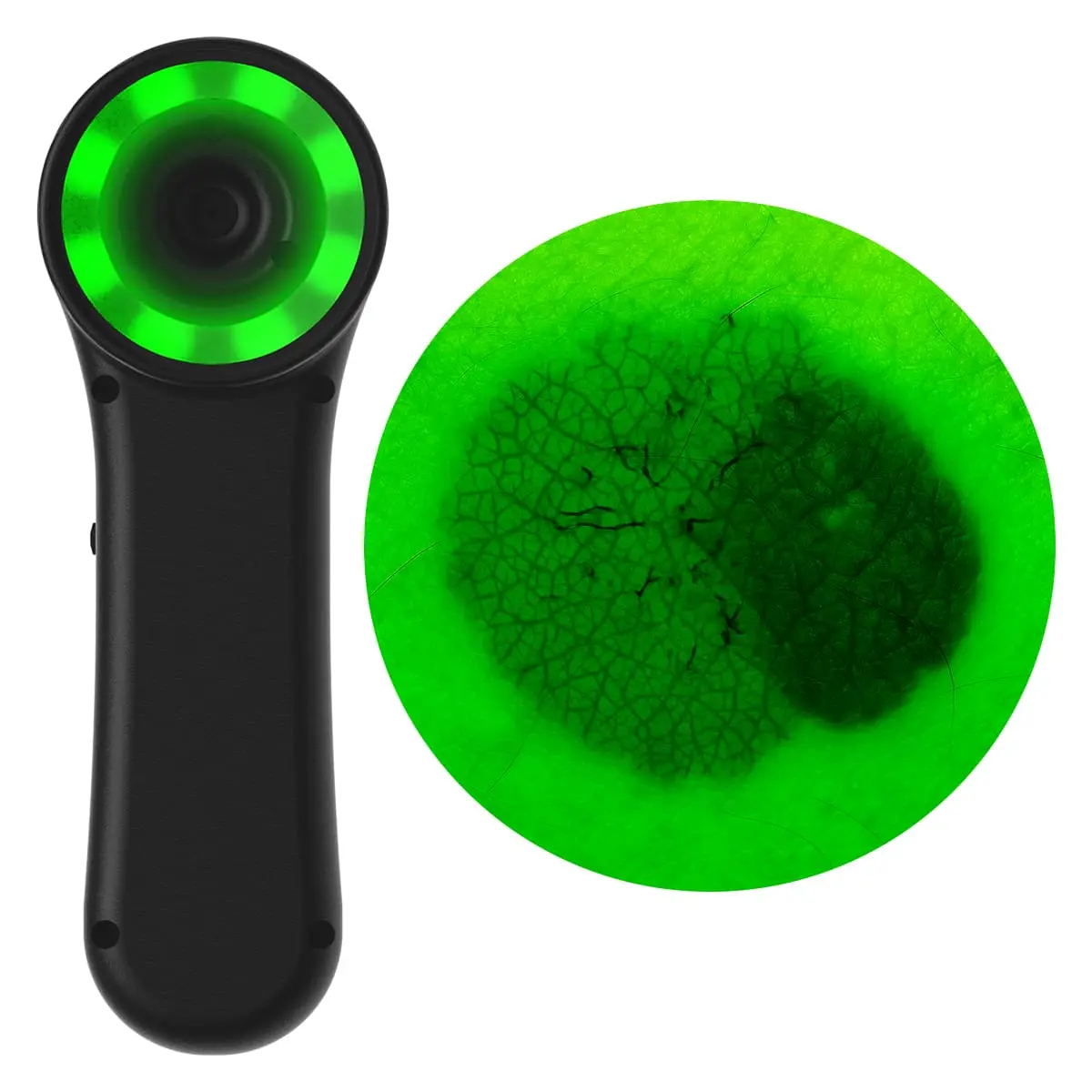 DocCheck Thïngs Digitales Dermatoskop "Scaut®"