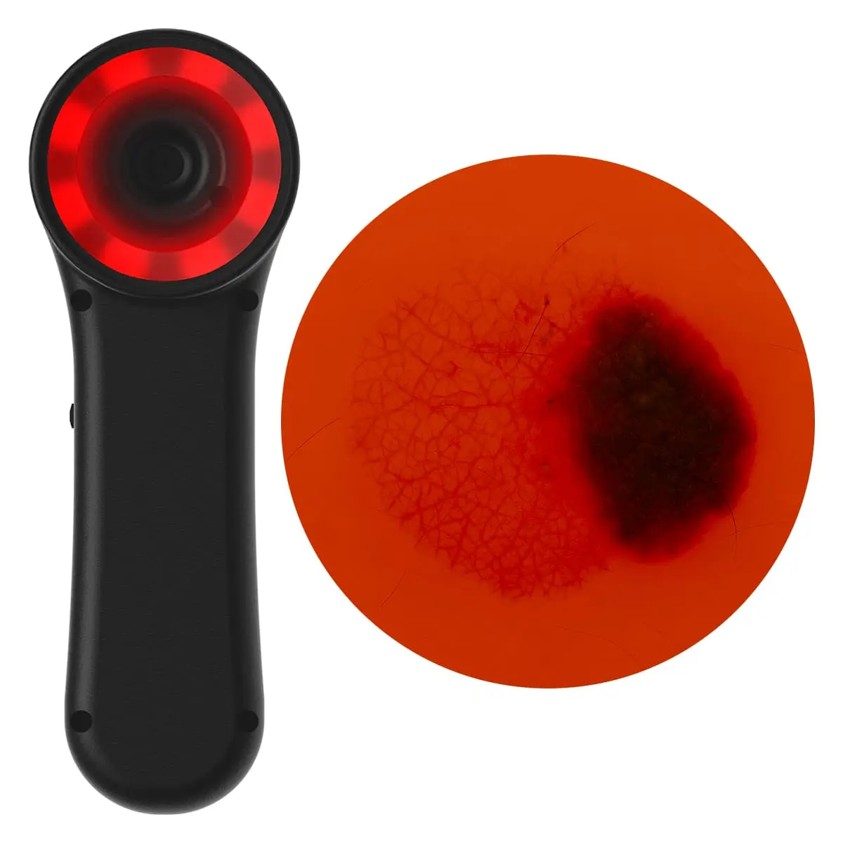 DocCheck Thïngs Digitales Dermatoskop "Scaut®"