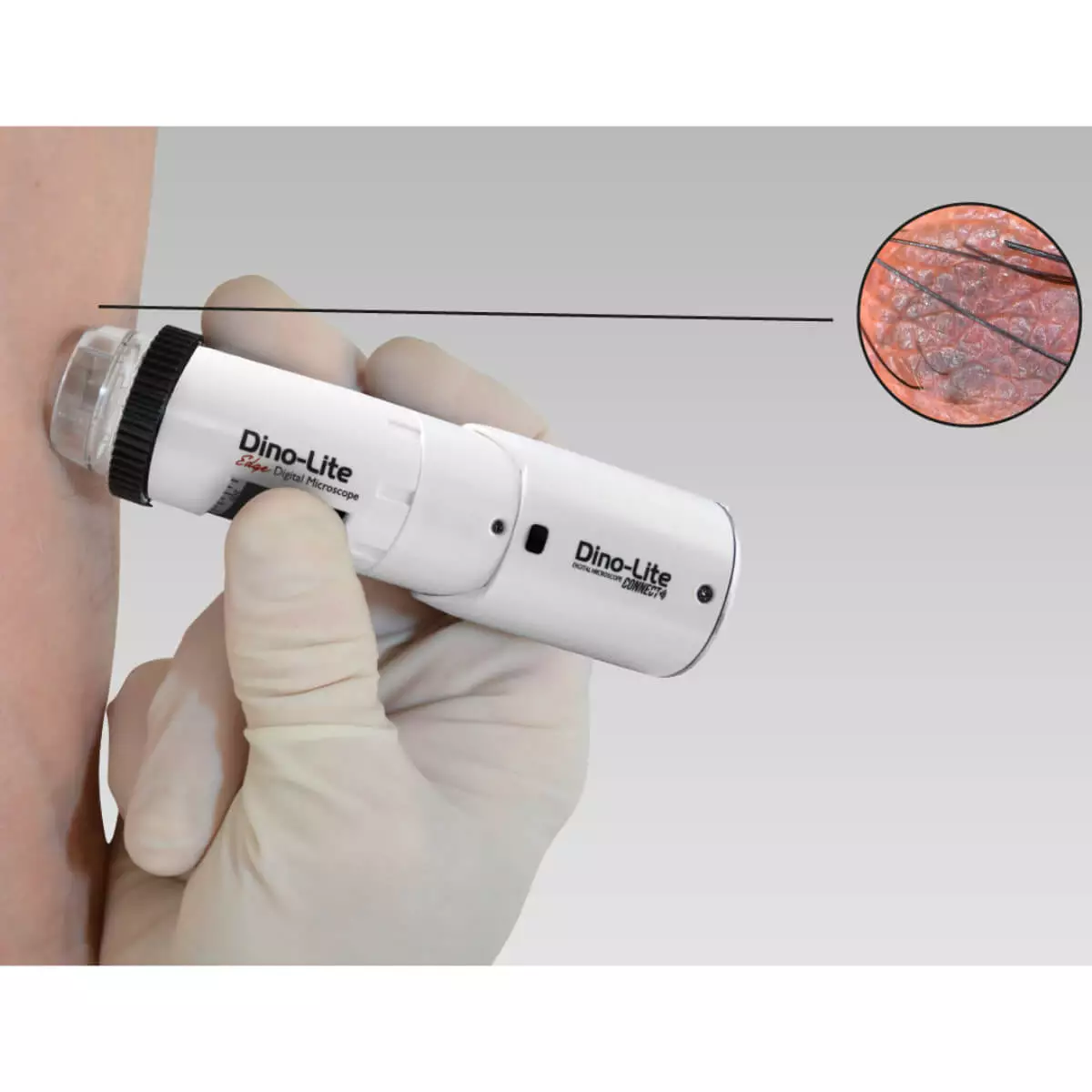 Dino-Lite DermaScope Polarizer Wireless Videodermatoskop