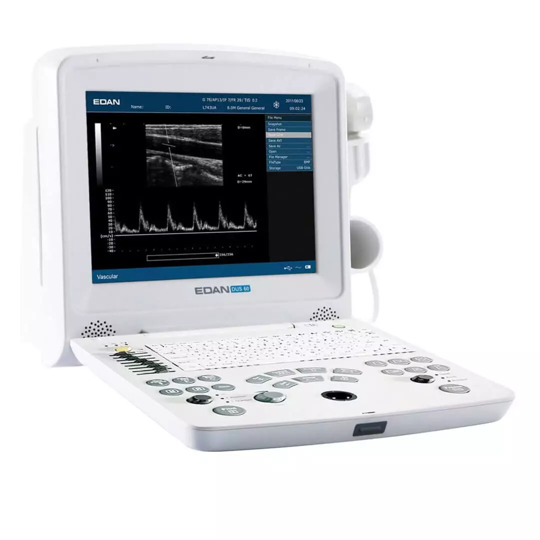 EDAN DUS 60 Ultraschallgerät