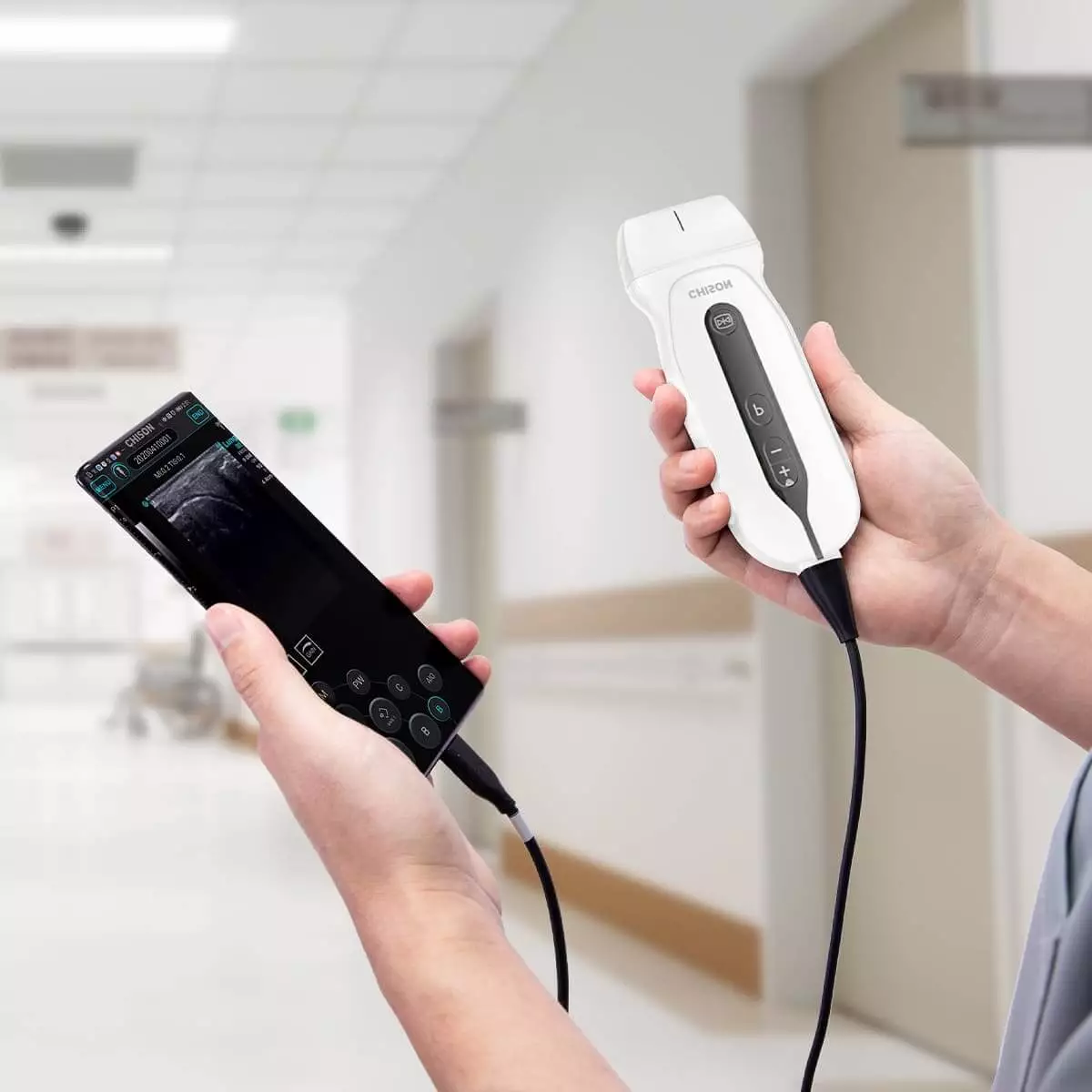 CHISON SonoEye G2 Handheld Ultraschallgerät