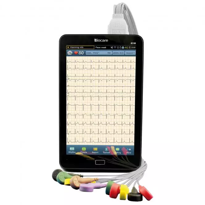 Biocare iE10 mobiles EKG