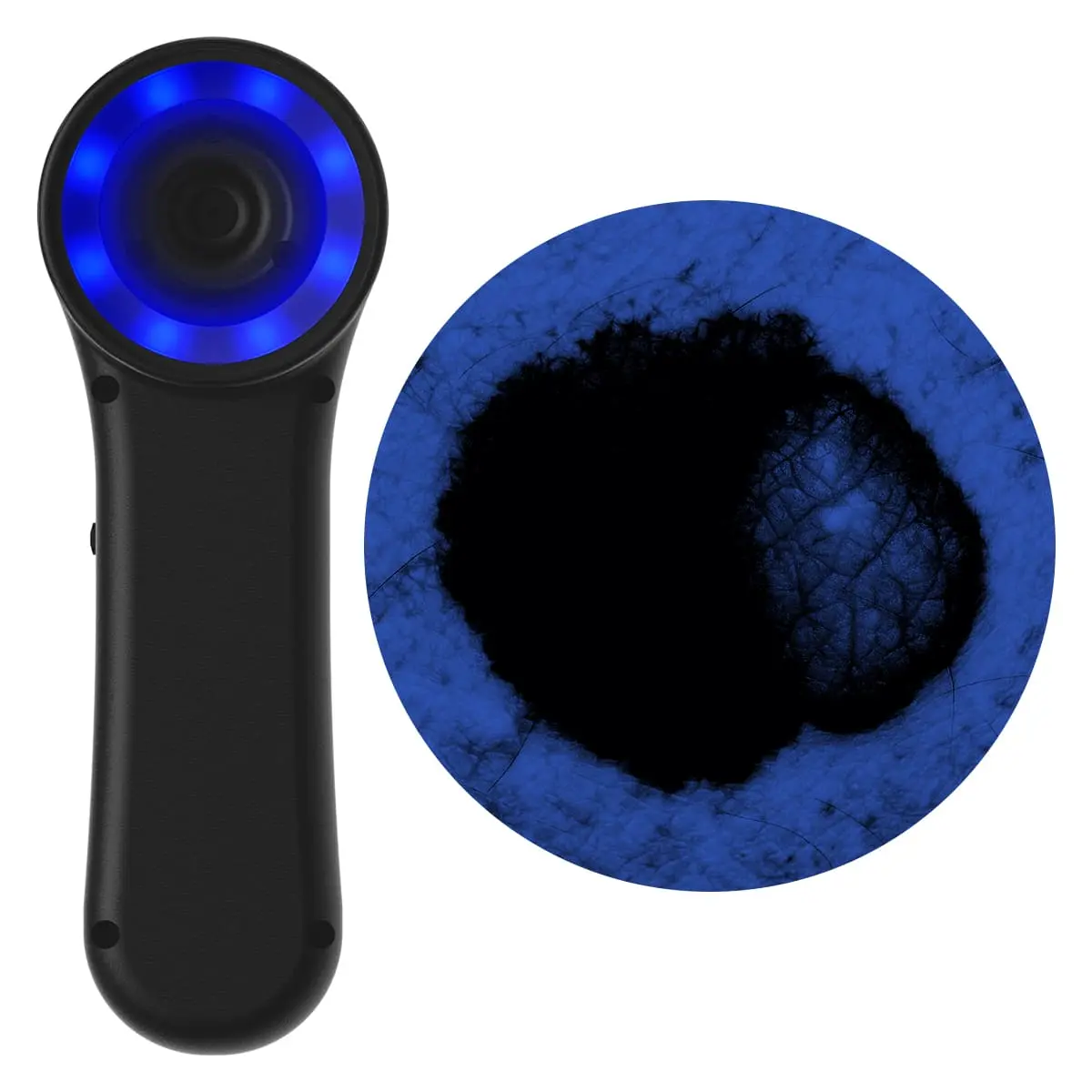 DocCheck Thïngs Digitales Dermatoskop "Scaut®"
