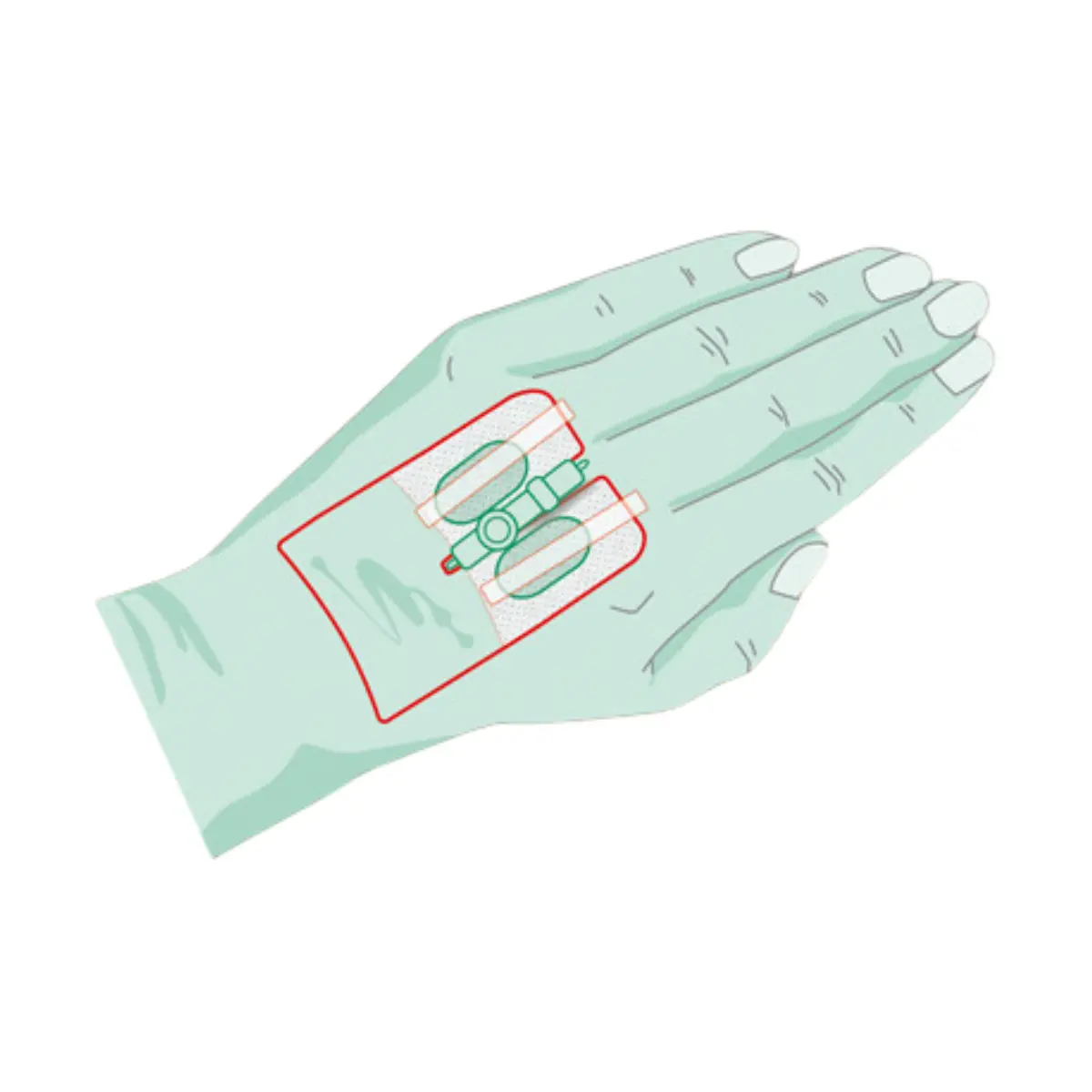 NOBAMED RUDAVEN-universal Kanülenfixierpflaster