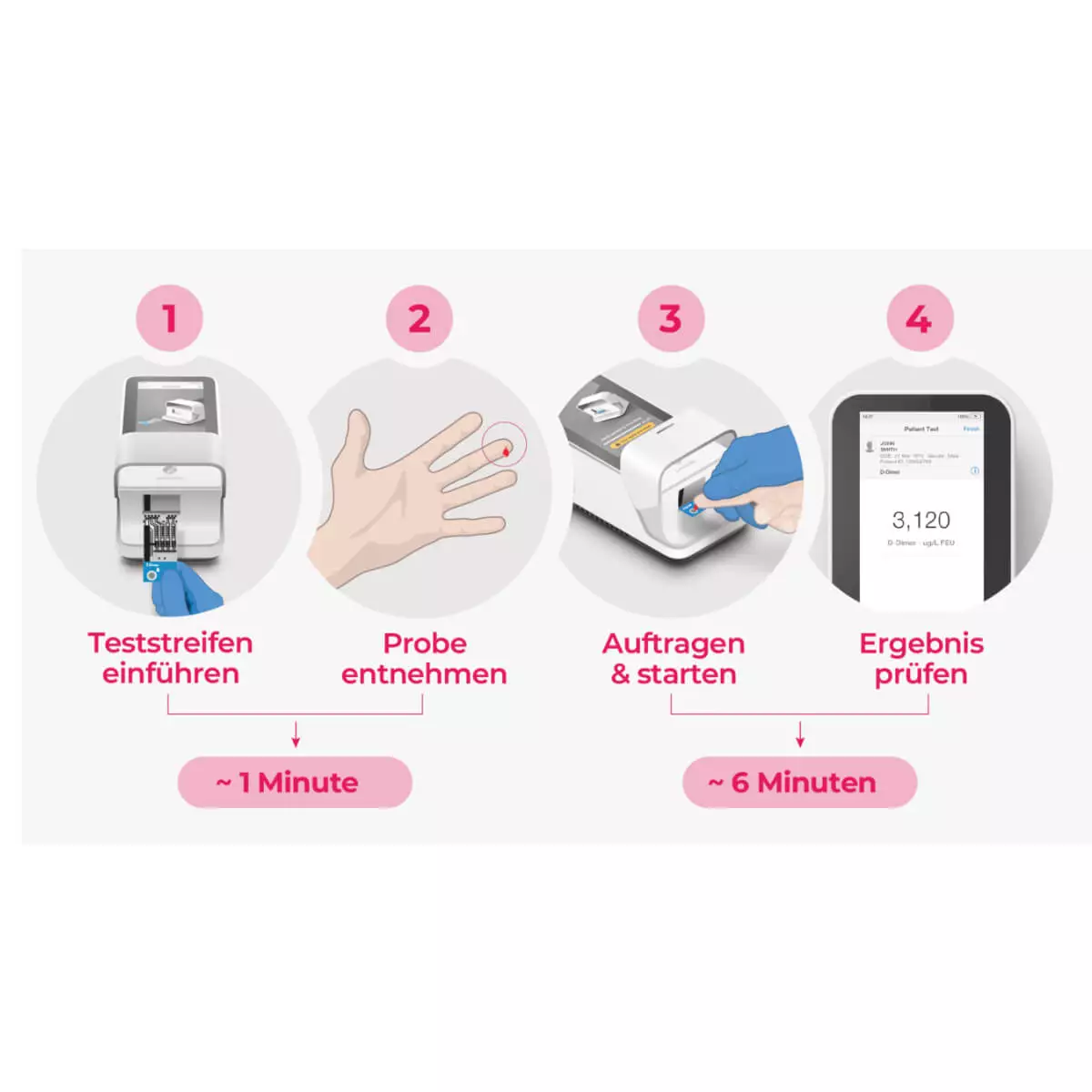 Roche LumiraDx D-Dimer Test