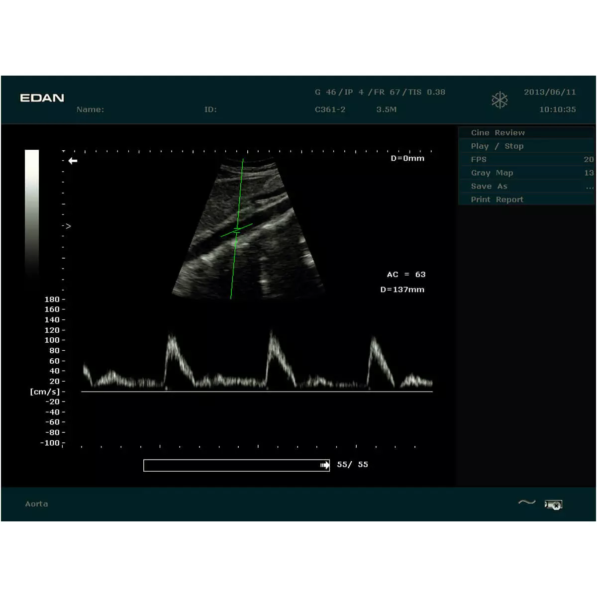 EDAN DUS 60 Ultraschallgerät