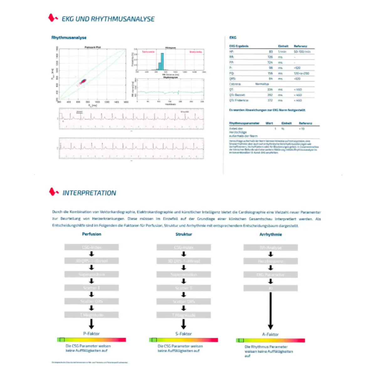 CARDISIO Cardisio KI-gestütztes 3D-EKG CARDISIO Cardisio KI-gestütztes 3D-EKG