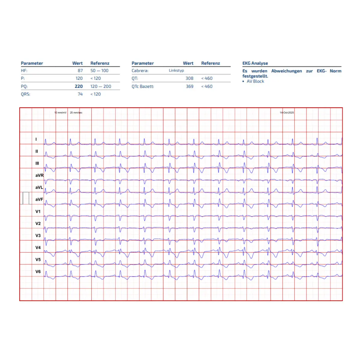 CARDISIO Cardisio KI-gestütztes 3D-EKG CARDISIO Cardisio KI-gestütztes 3D-EKG