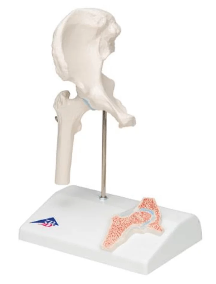 3B Scientific Mini-Modell Hüftgelenk