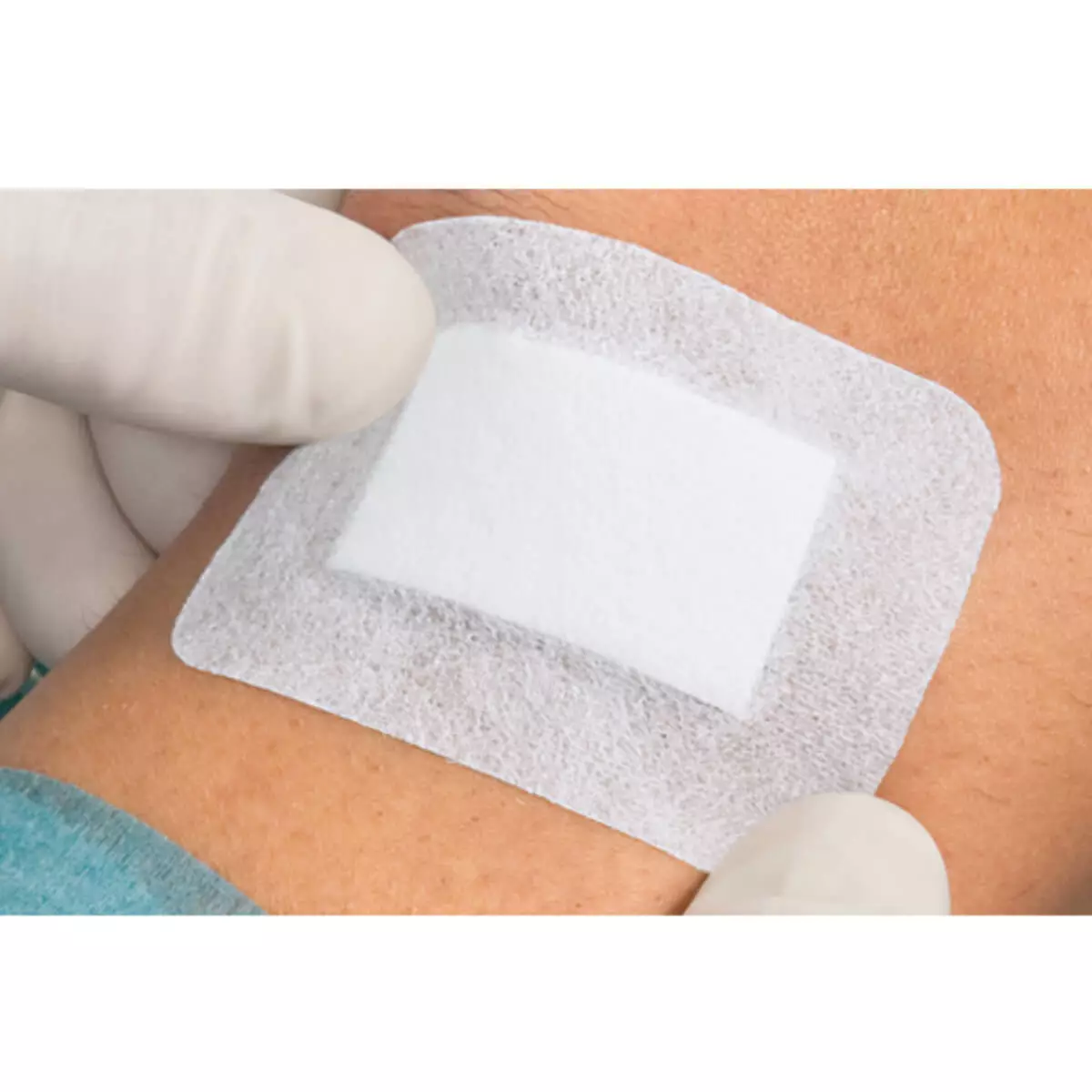 HARTMANN Cosmopor Advance Wundverband