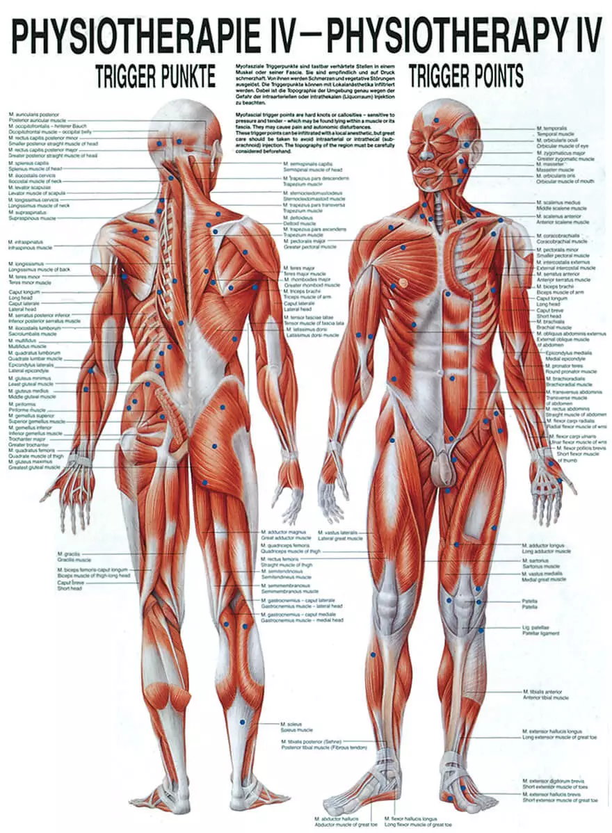 Rüdiger Anatomie Lehrtafel – Trigger Punkte