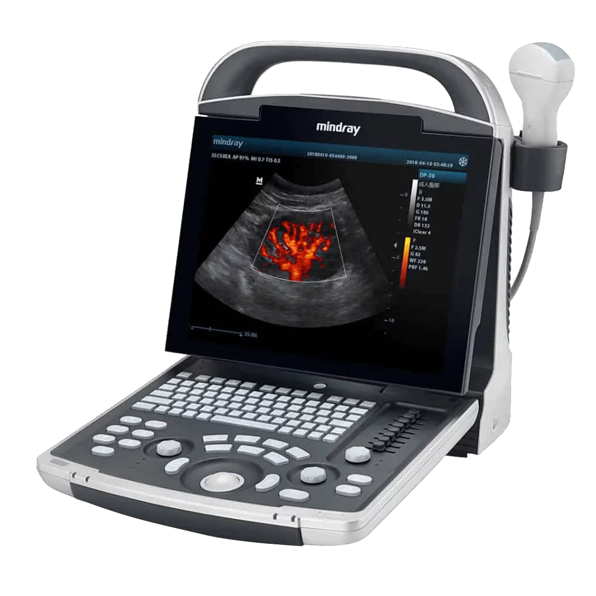 Mindray DP-30 Ultraschallgerät