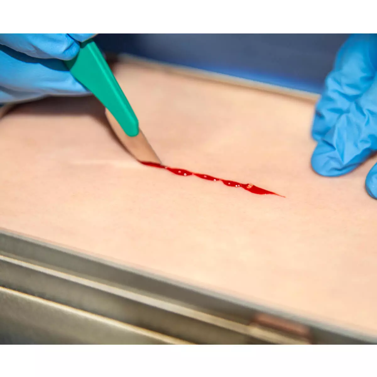 UpSurgeOn SkinPad