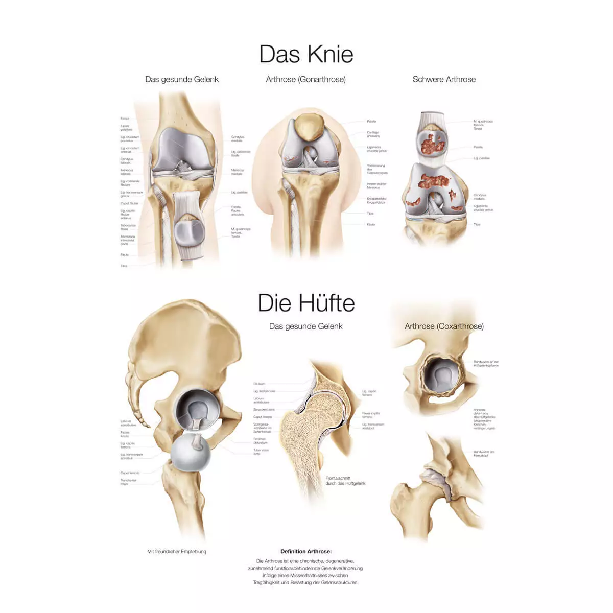 Erler-Zimmer Lehrtafel – Das Knie / Die Hüfte