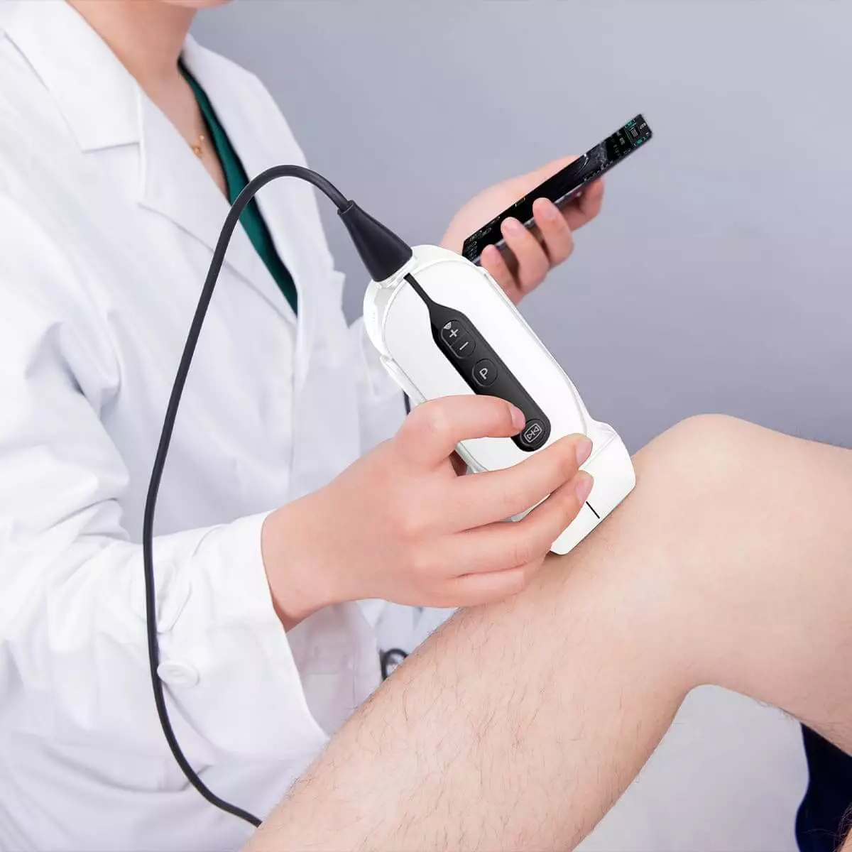 CHISON SonoEye G2 Handheld Ultraschallgerät