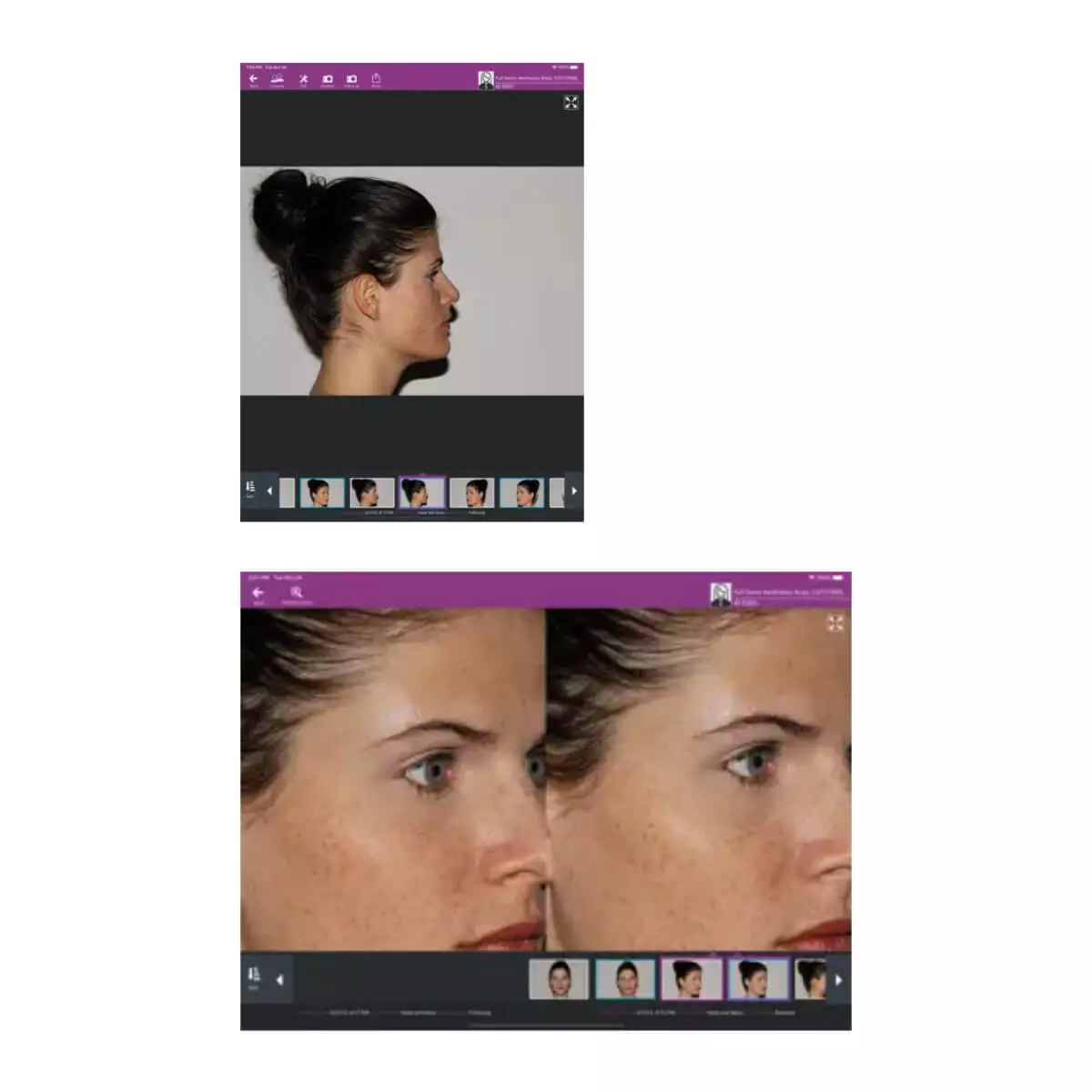 FotoFinder Systems meesma Bildsystem für iOS & FotoFinder Hub Cloud-Dienst