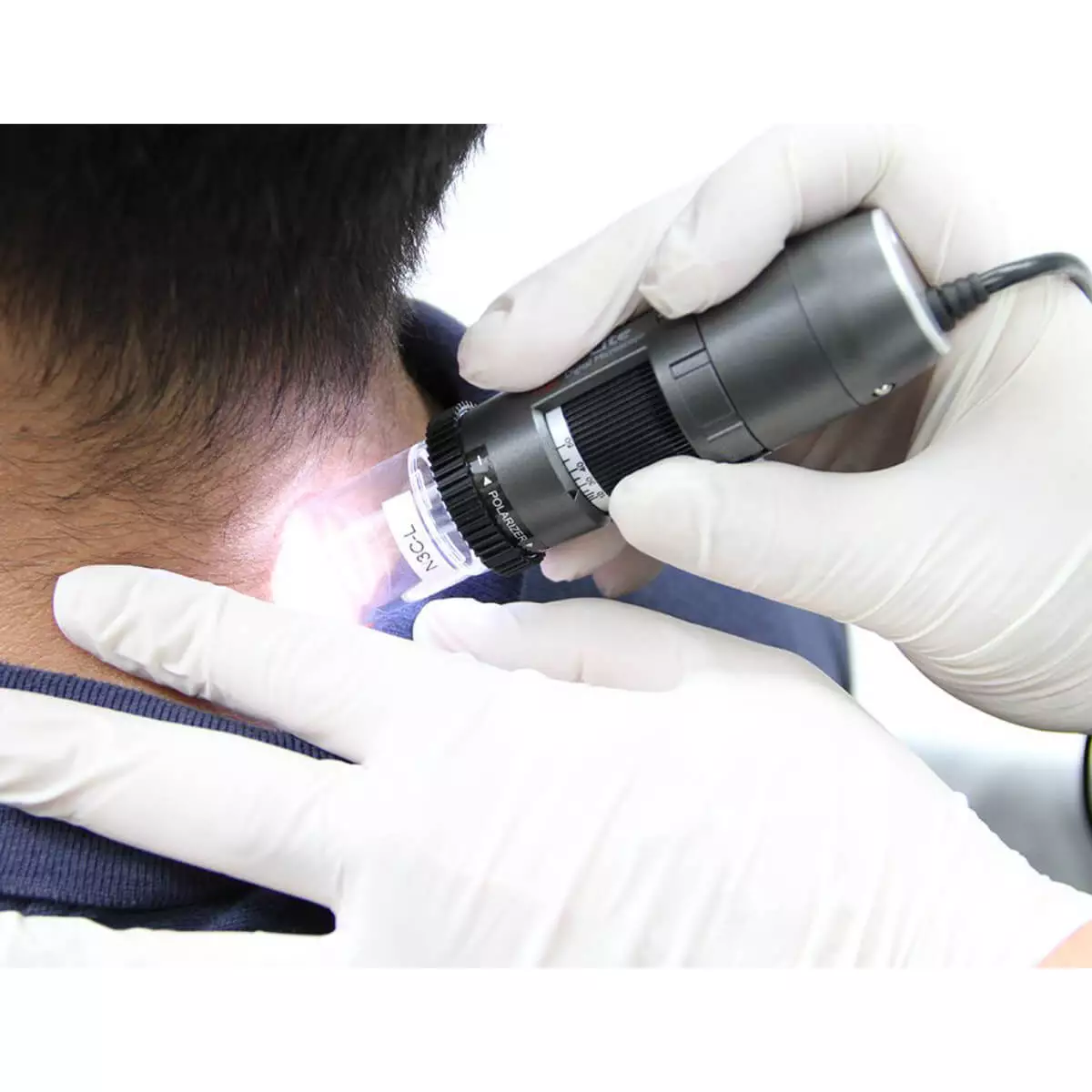 Dino-Lite DermaScope Polarizer HR 200x Videodermatoskop