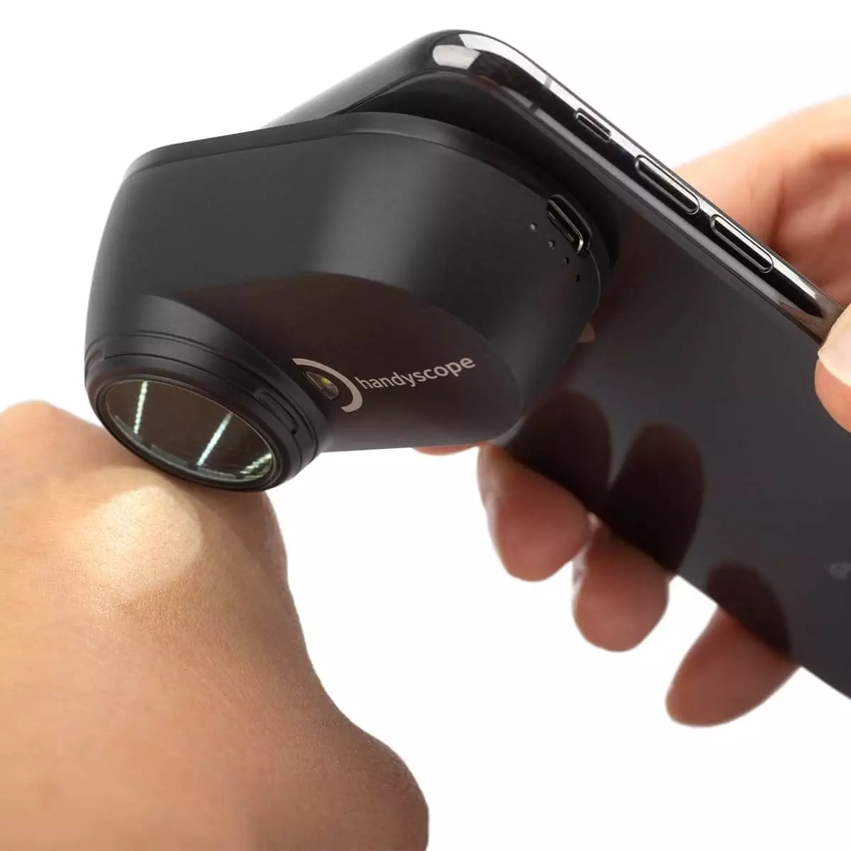 DermLite DermLite Handyscope